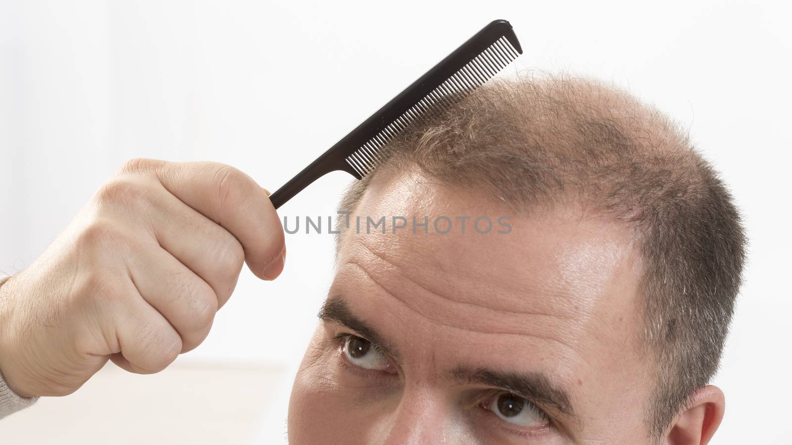 adult man hand holding comb on bald head by CatherineL-Prod