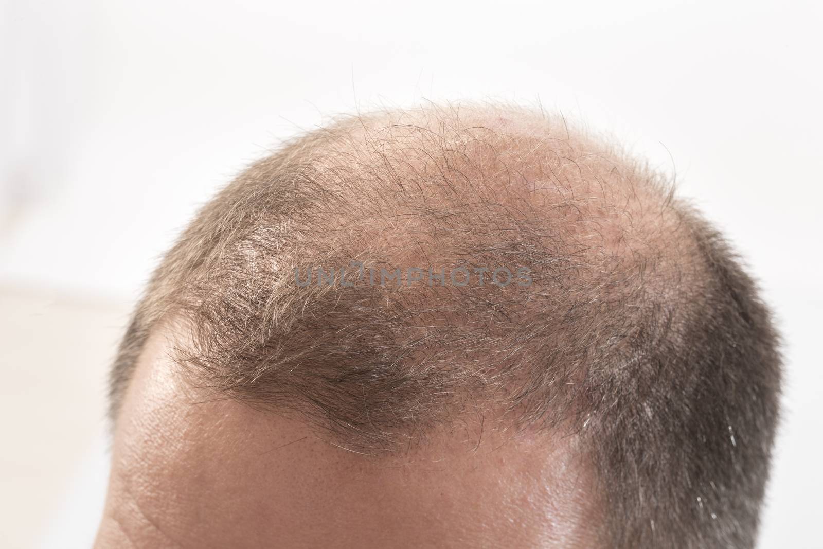 40s man with an incipient baldness , close-up, white background