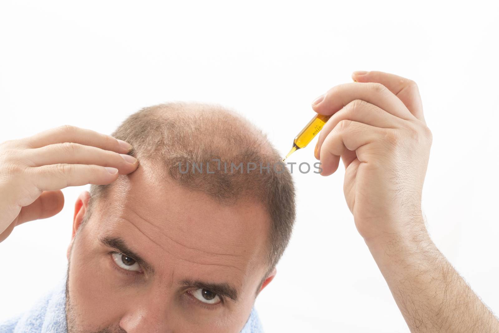 Premature baldness, man, 40s, white background by CatherineL-Prod