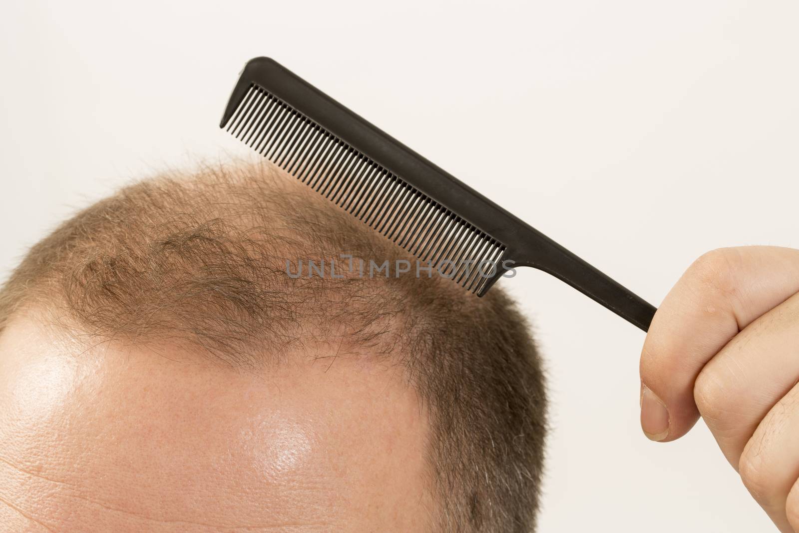 adult man hand holding comb on bald head by CatherineL-Prod