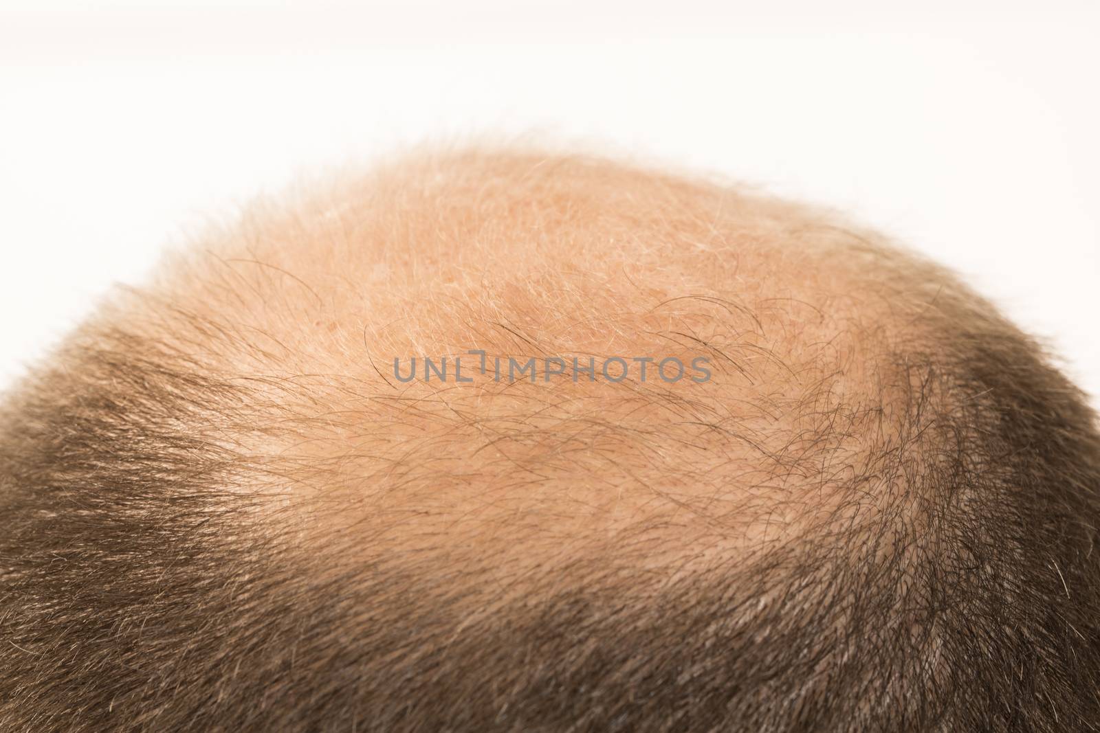 Premature baldness, man, 40s, white background by CatherineL-Prod