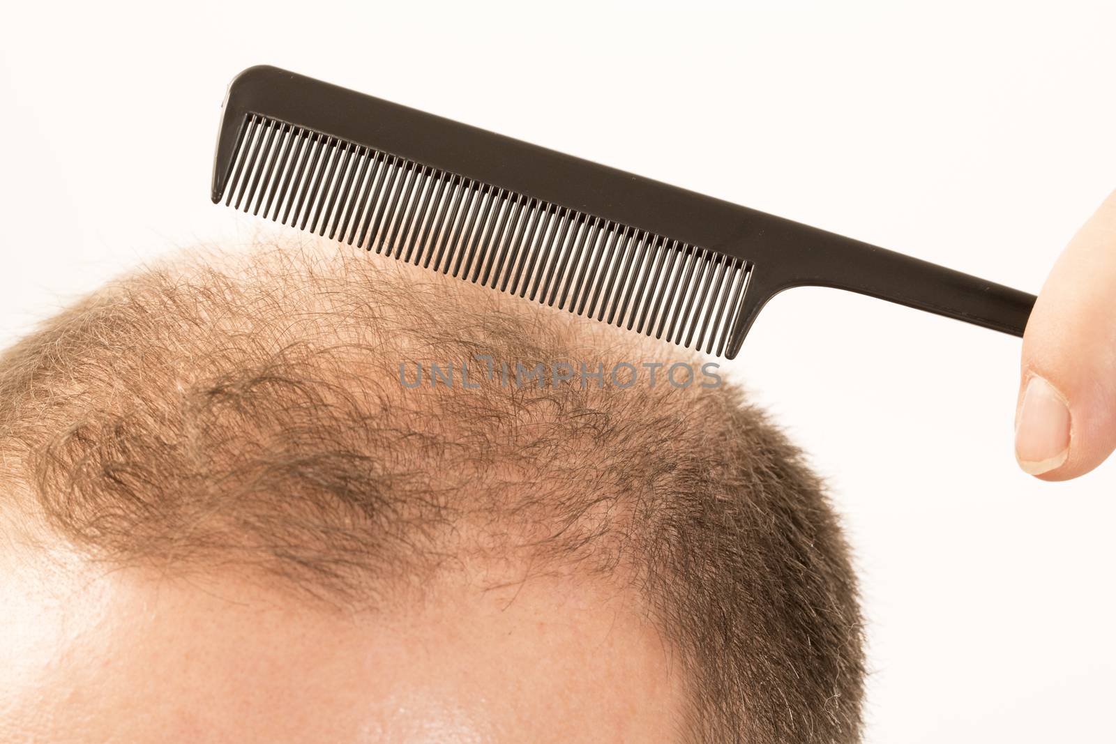 adult man hand holding comb on bald head by CatherineL-Prod