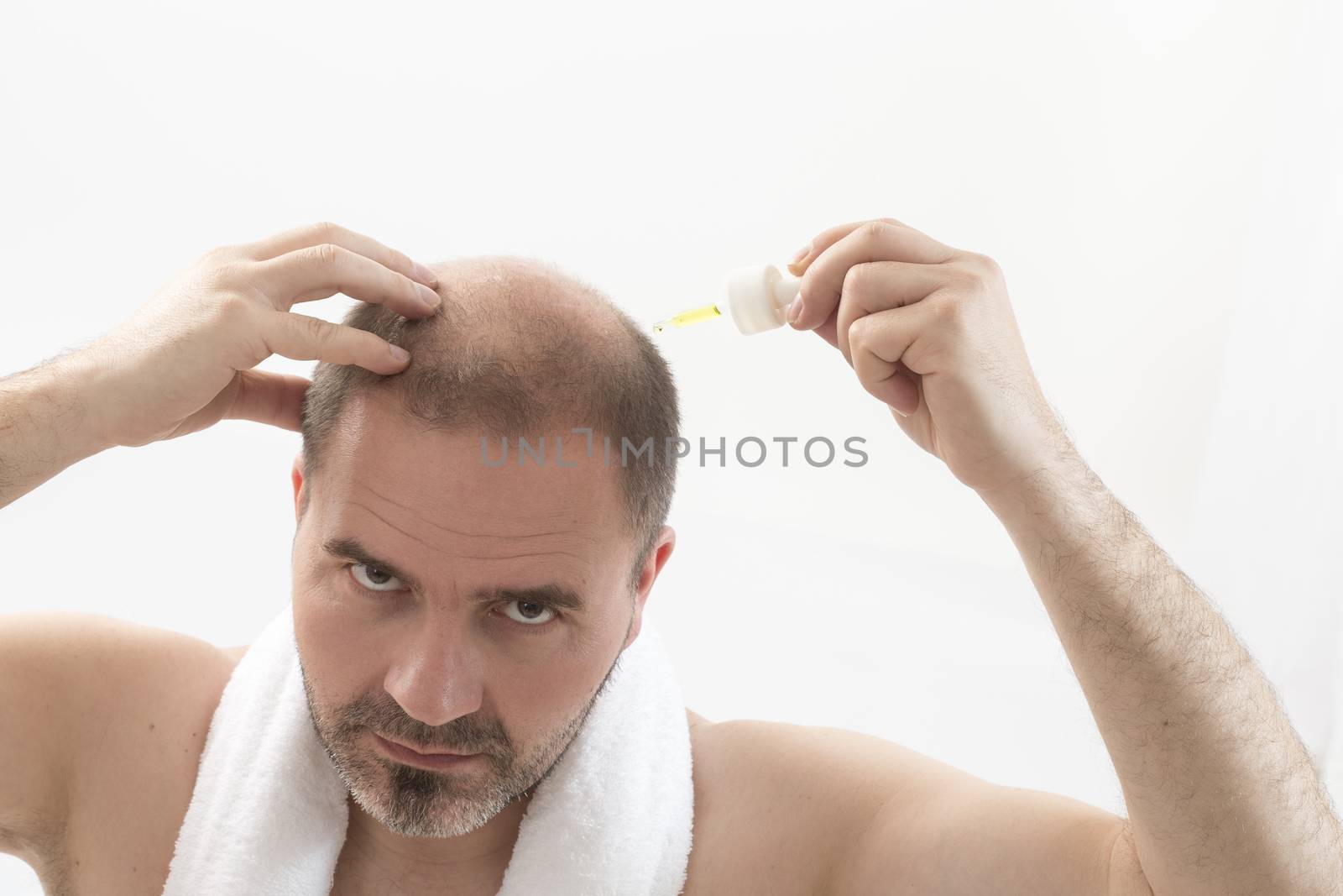 Premature baldness, man, 40s, white background by CatherineL-Prod