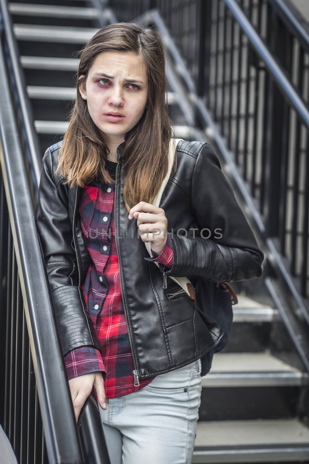 Young Badly Bruised and Frightened Girl with Backpack on Staircase.