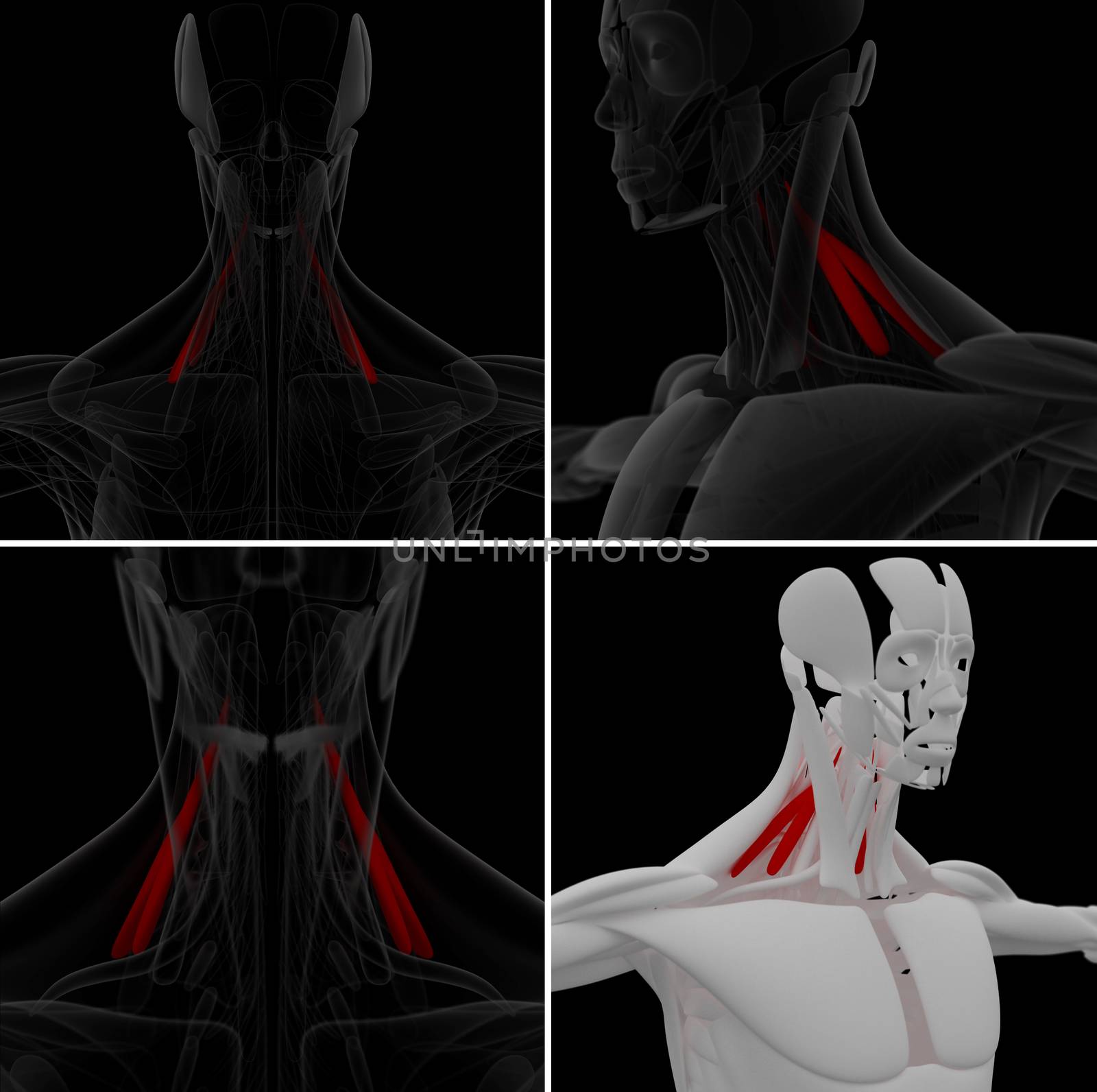 medical illustration of the Scalenus
