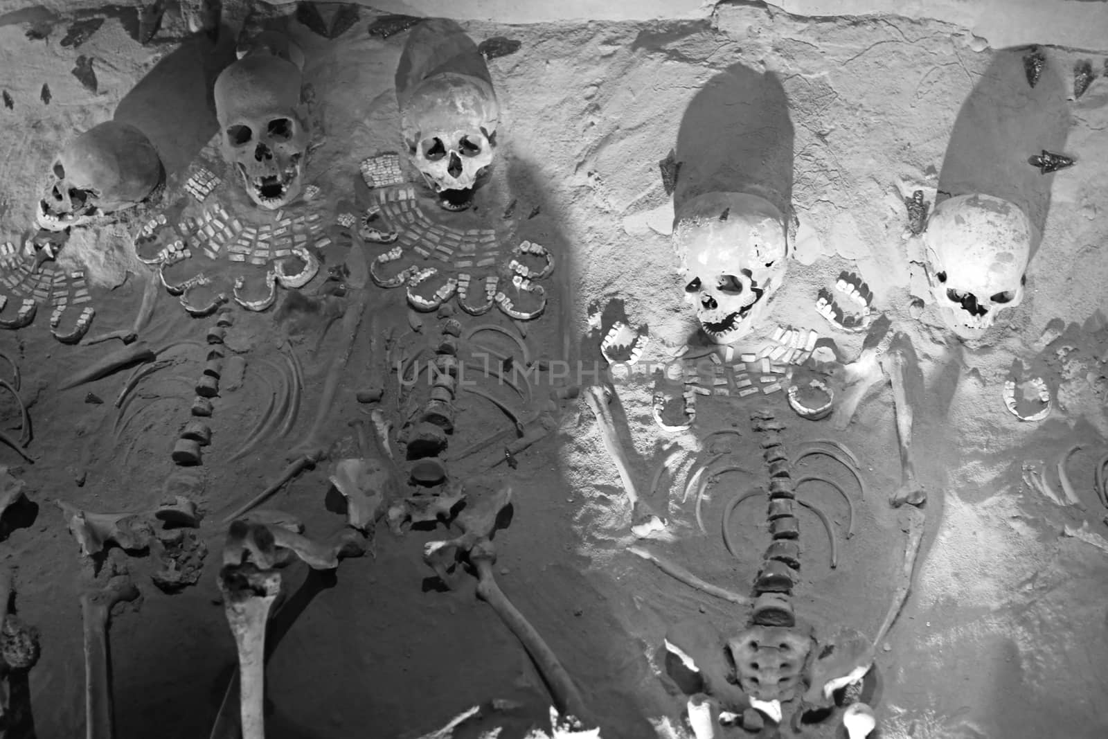 Skull and other human bones in dark tones