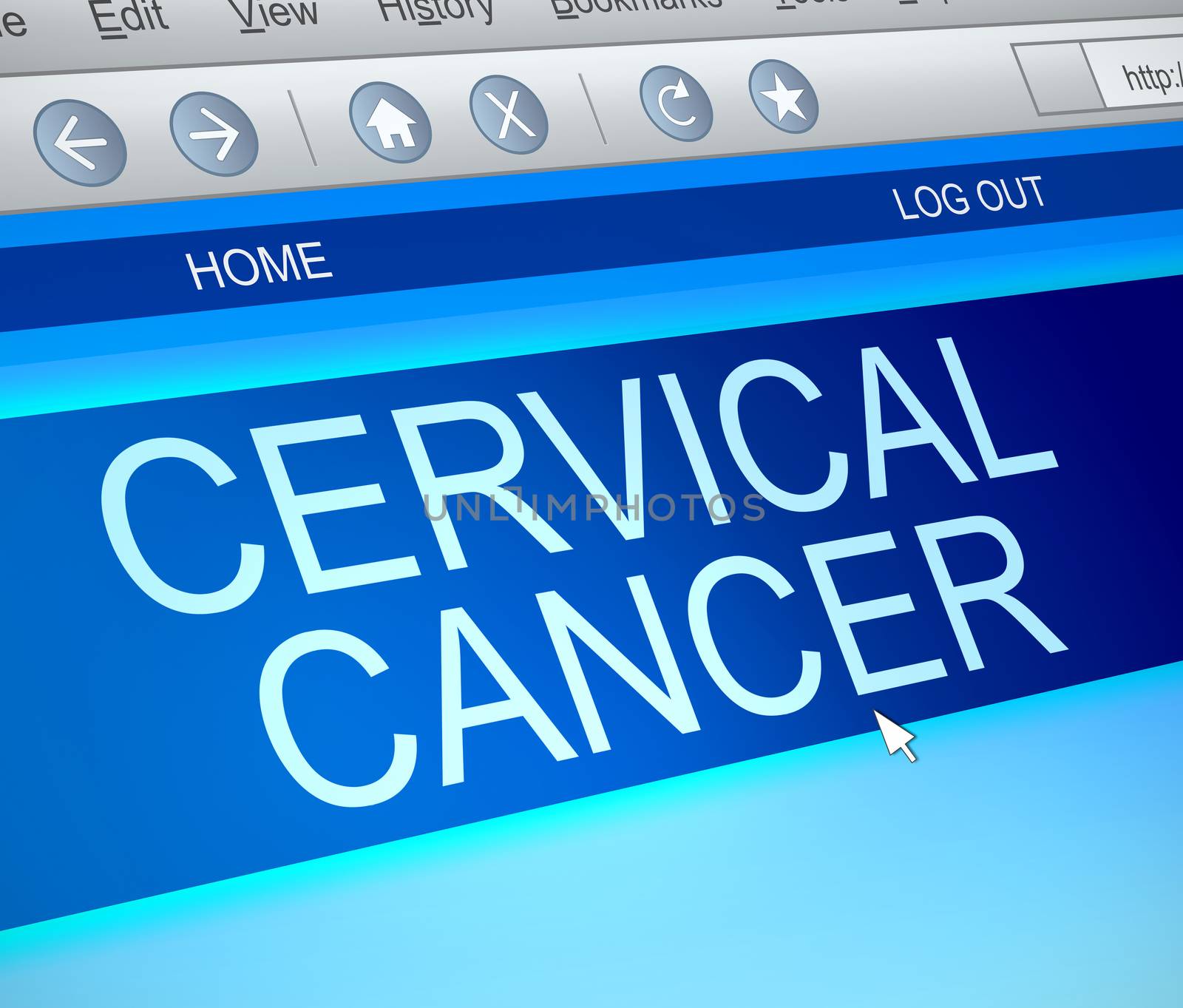 Cervical cancer information concept. by 72soul