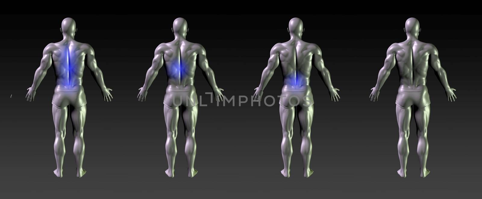 Spine Recovery or Rehabilitation with Blue Glow