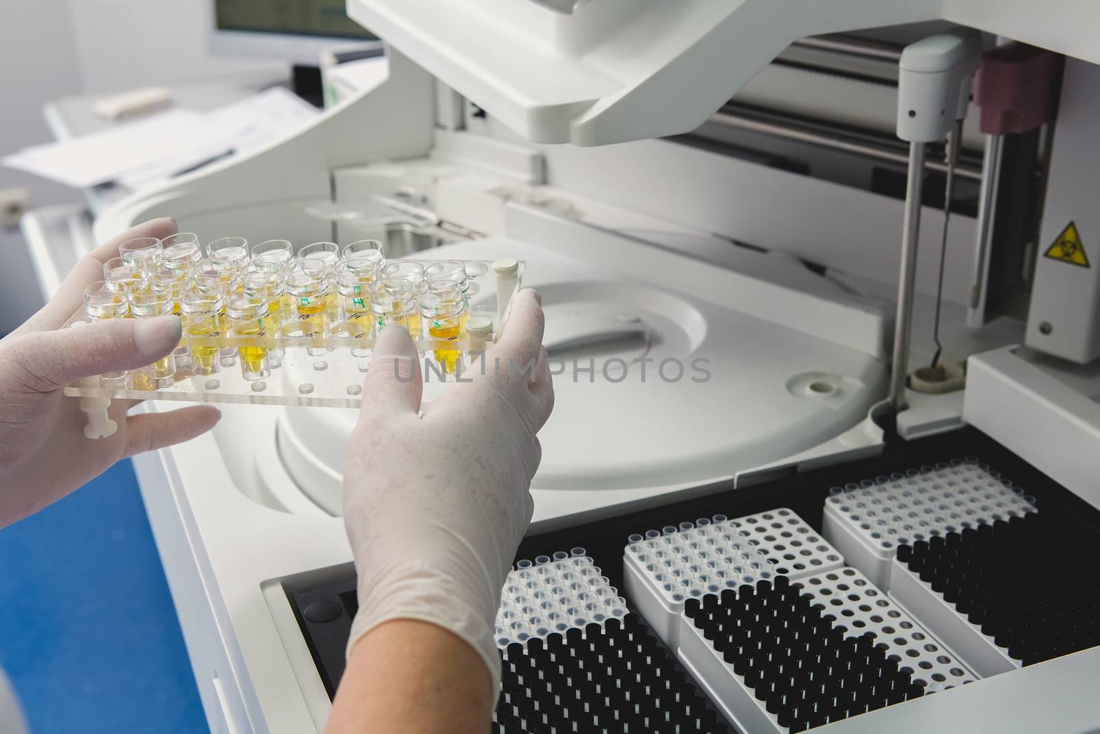 Lab tech loading samples into a chemistry analyzer in clinic