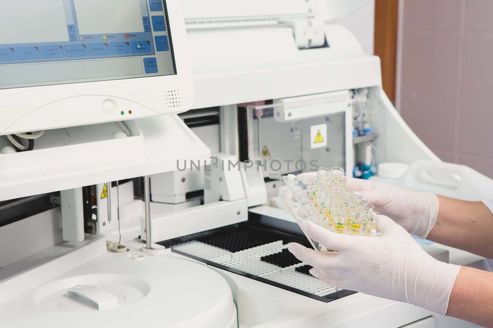 Lab tech loading samples into a chemistry analyzer in clinic