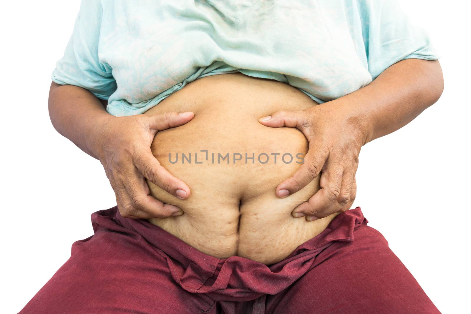 asian old fat woman grasp her abdomen ( surgical scar at lower abdomen ( post cesarean section ) ) ( isolated background ) by stockdevil