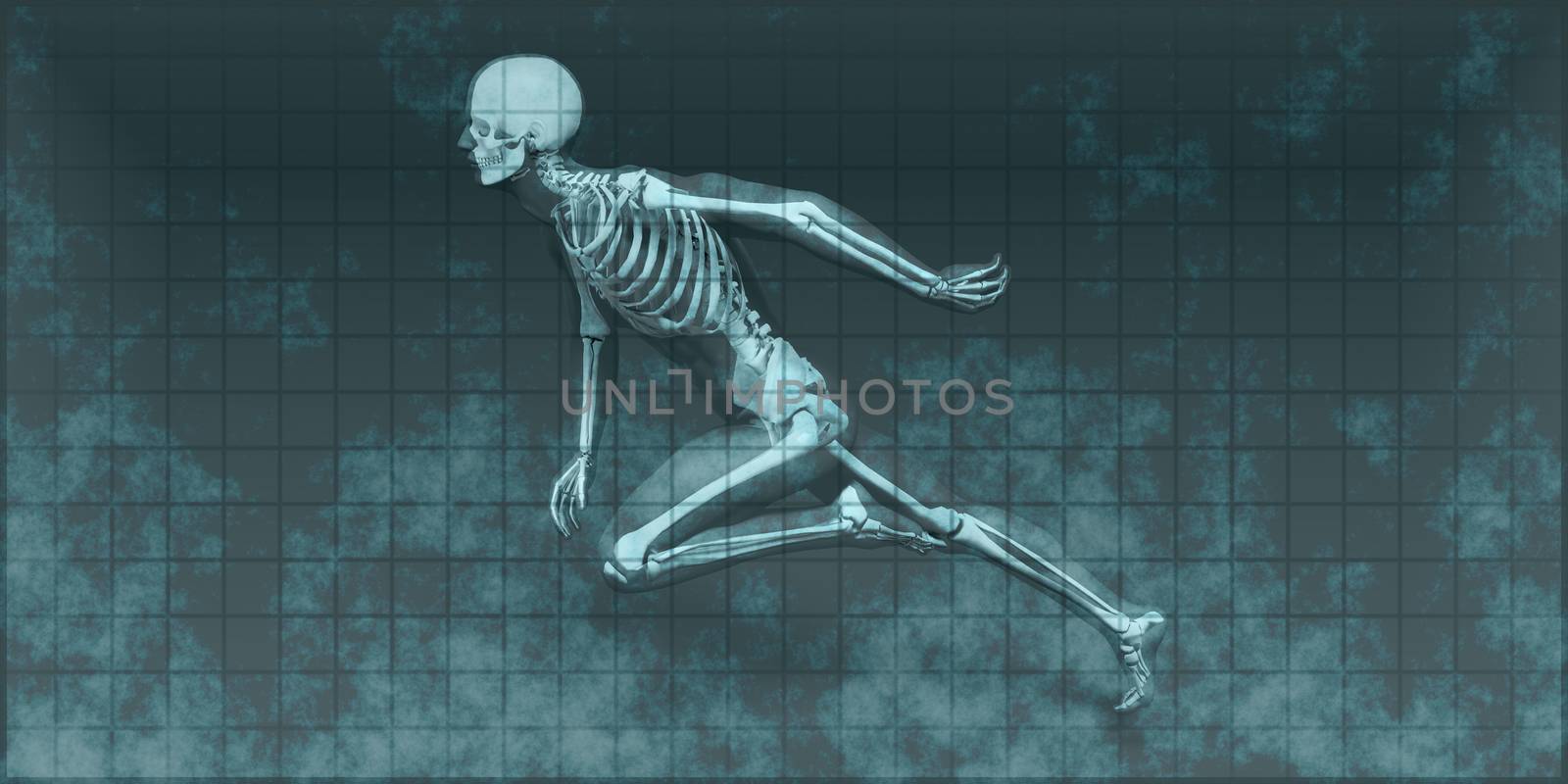 Radiography Scan with Bones as a Science Concept