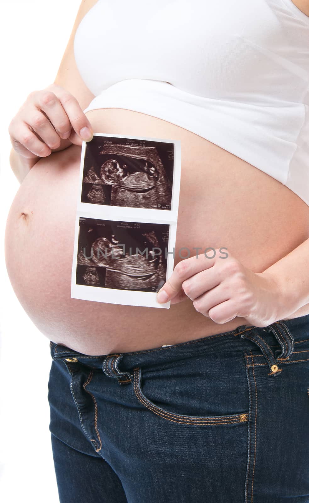 Pregnant young woman showing ultrasound pisture of her baby