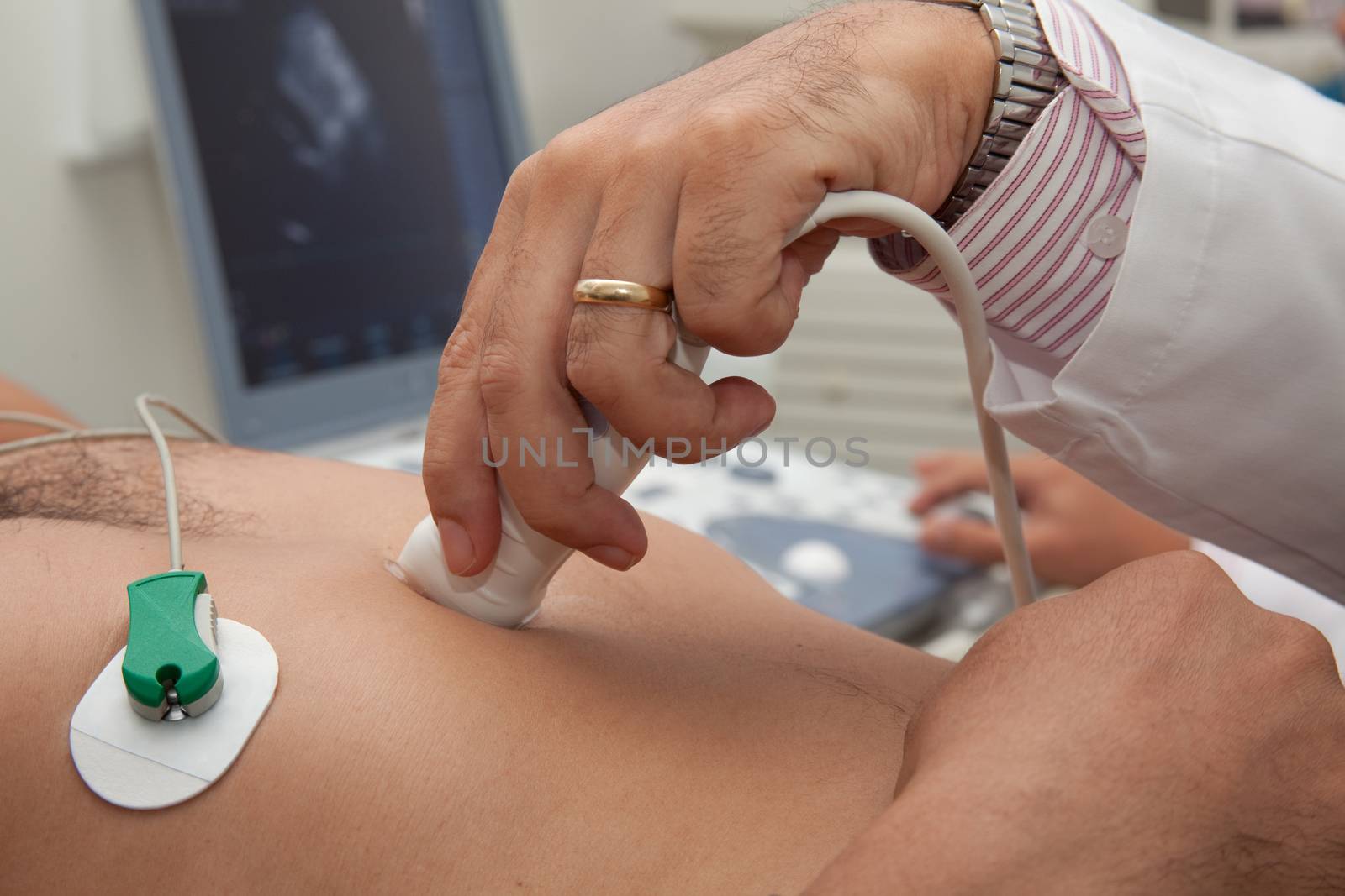 Doctor performing an echocardiogram