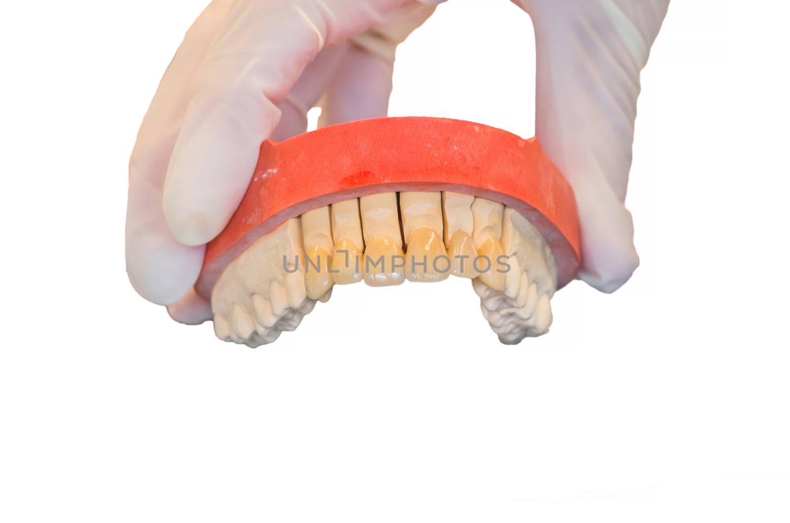 Dentures, prosthesis and oral hygiene. Hands with gloves while working on a dental prosthesis.