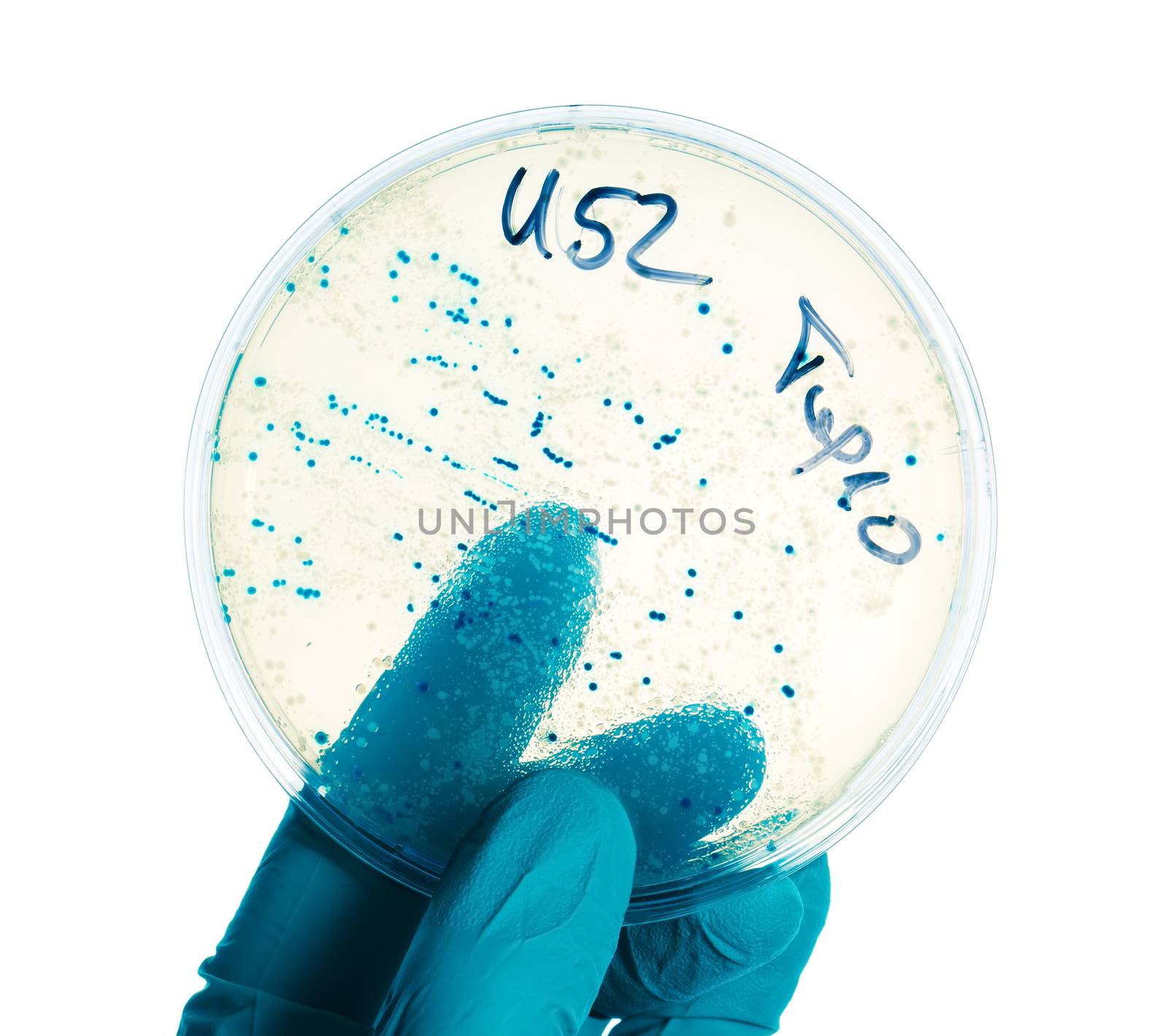Hand in nitril glove holds Petri dish with bacterial colonies