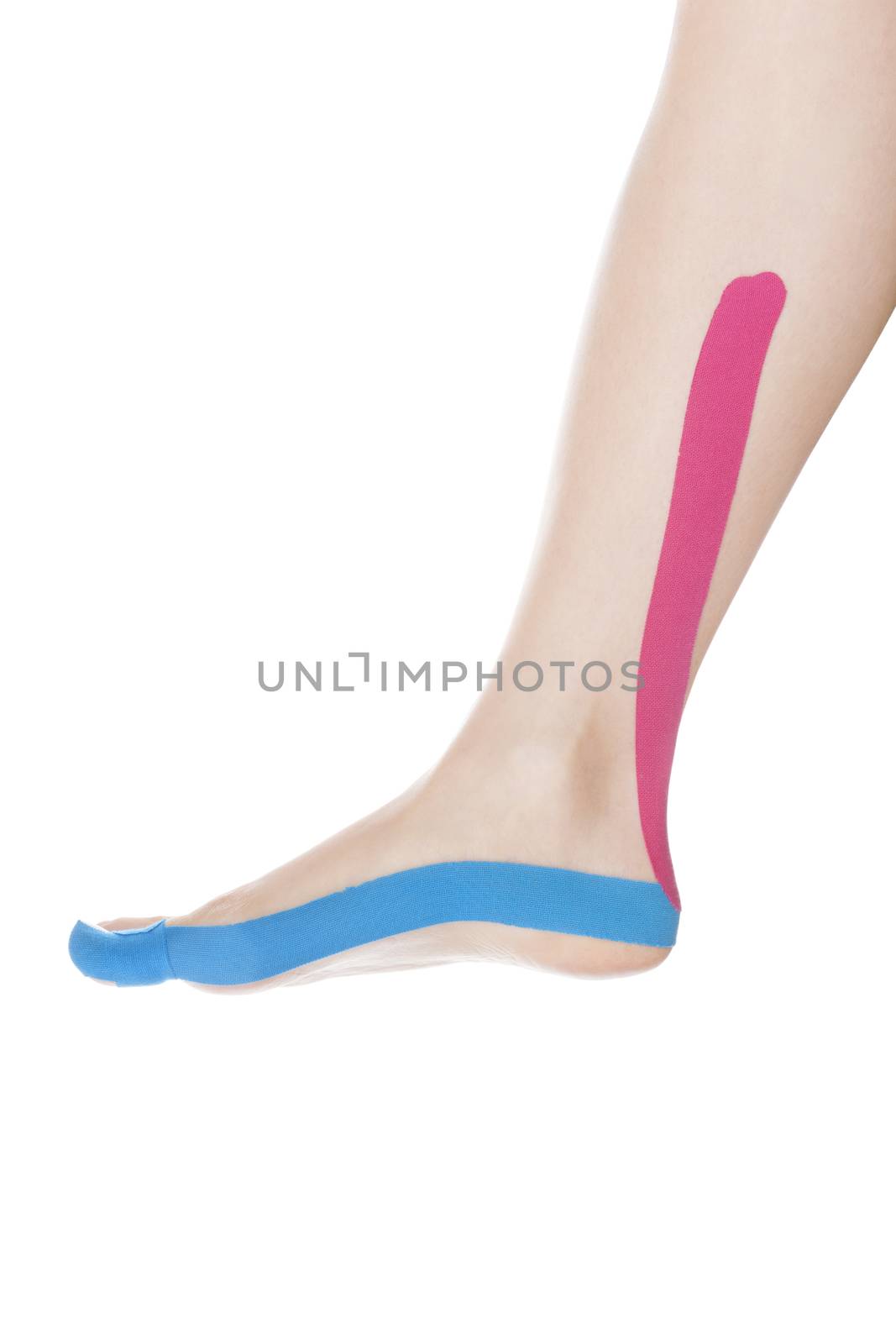 Therapeutic tape on female foot. by eskymaks