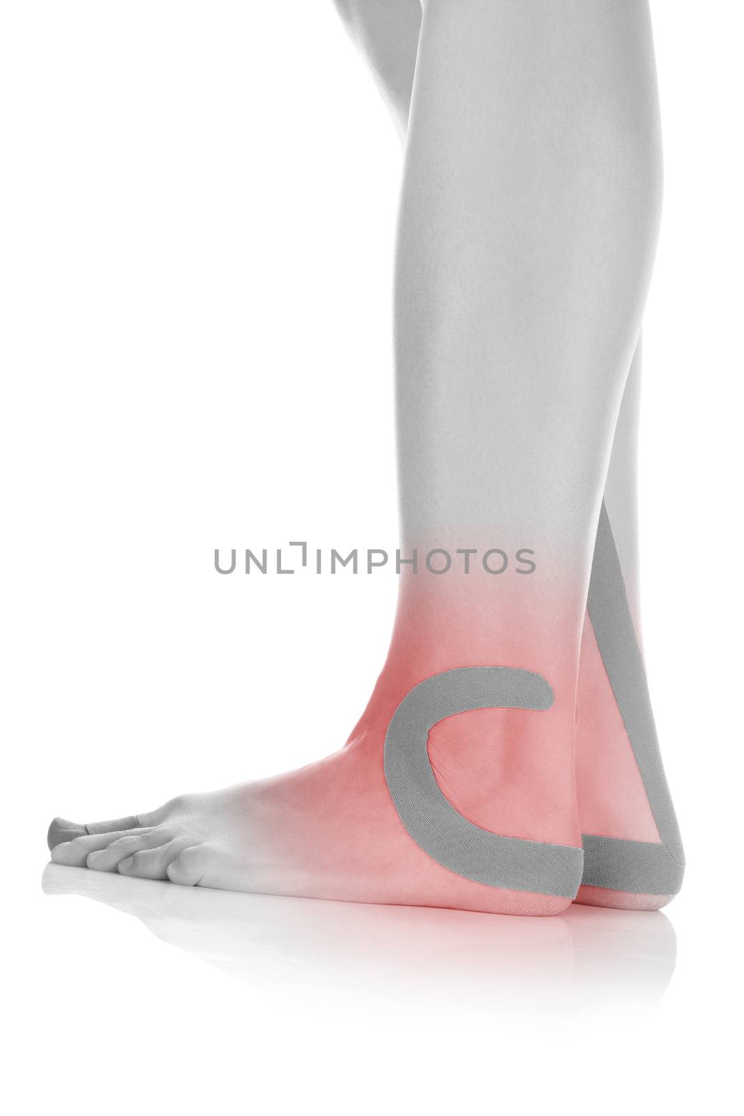 Therapeutic tape on female foot isolated on white background. Chronic pain, alternative medicine. Rehabilitation and physiotherapy.