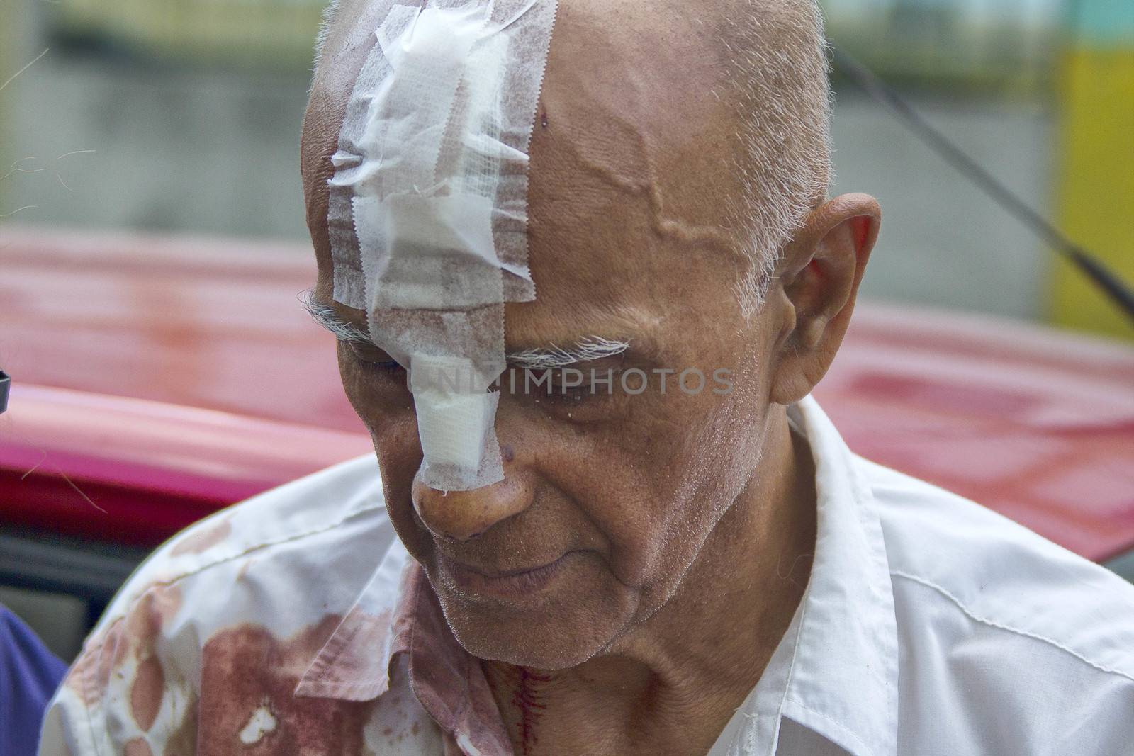 BRAZIL, Rio de Janeiro: A man walks with bandages on his head after being injured in a building explosion in Rio de Janeiro, Brazil on April 5, 2016.Five  people were killed and nine injured in the explosion. The fire department responded to the blast in the Coelho Neto neighborhood. Neighbors reported the smell of gas leaks for over a year, however the fire department declined to comment on what may have caused the explosion. 