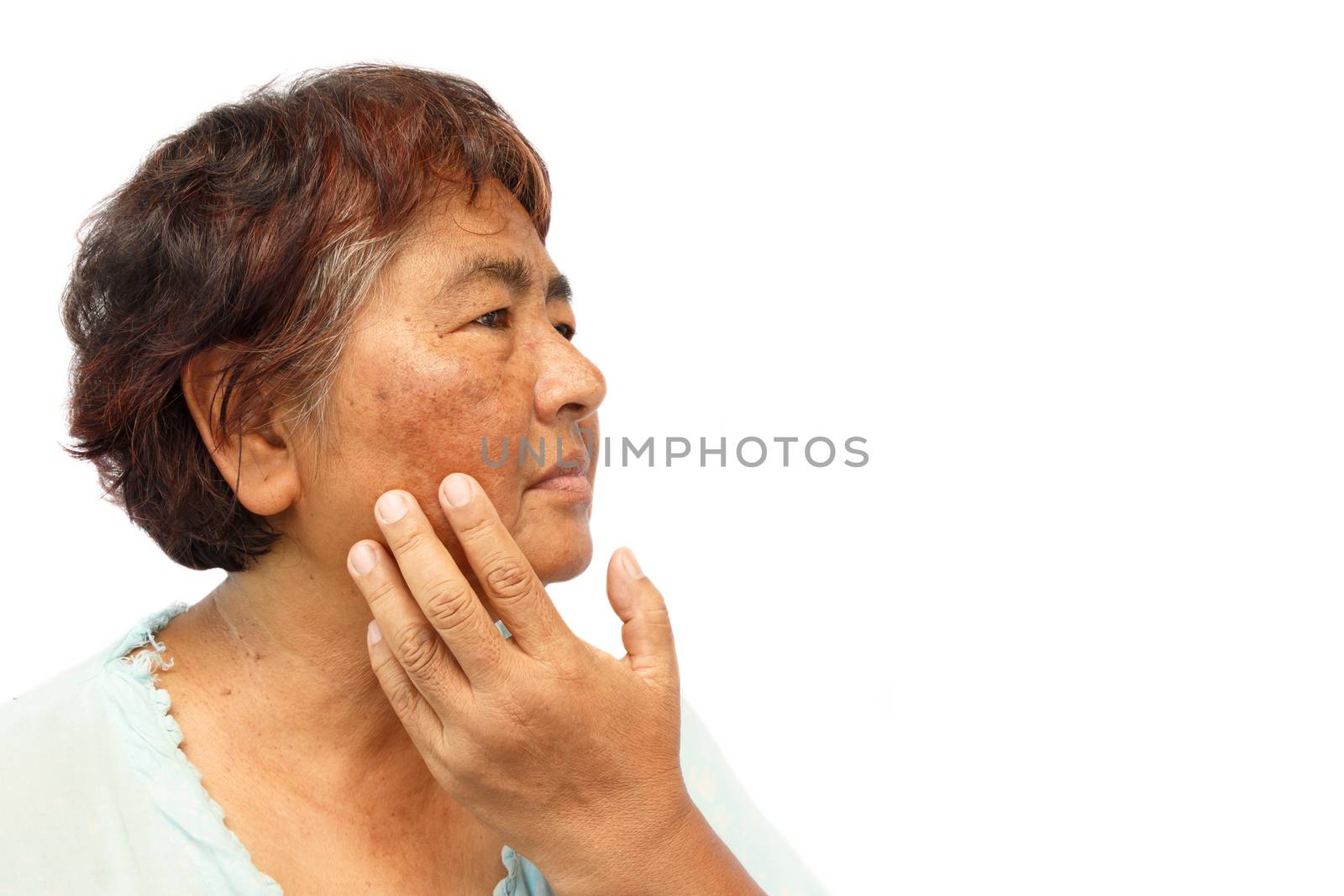 old rural woman with blemish , acne , mole and wrinkle on her face ( isolated background and blank area at right side ) ( anti-aging concept ) by stockdevil