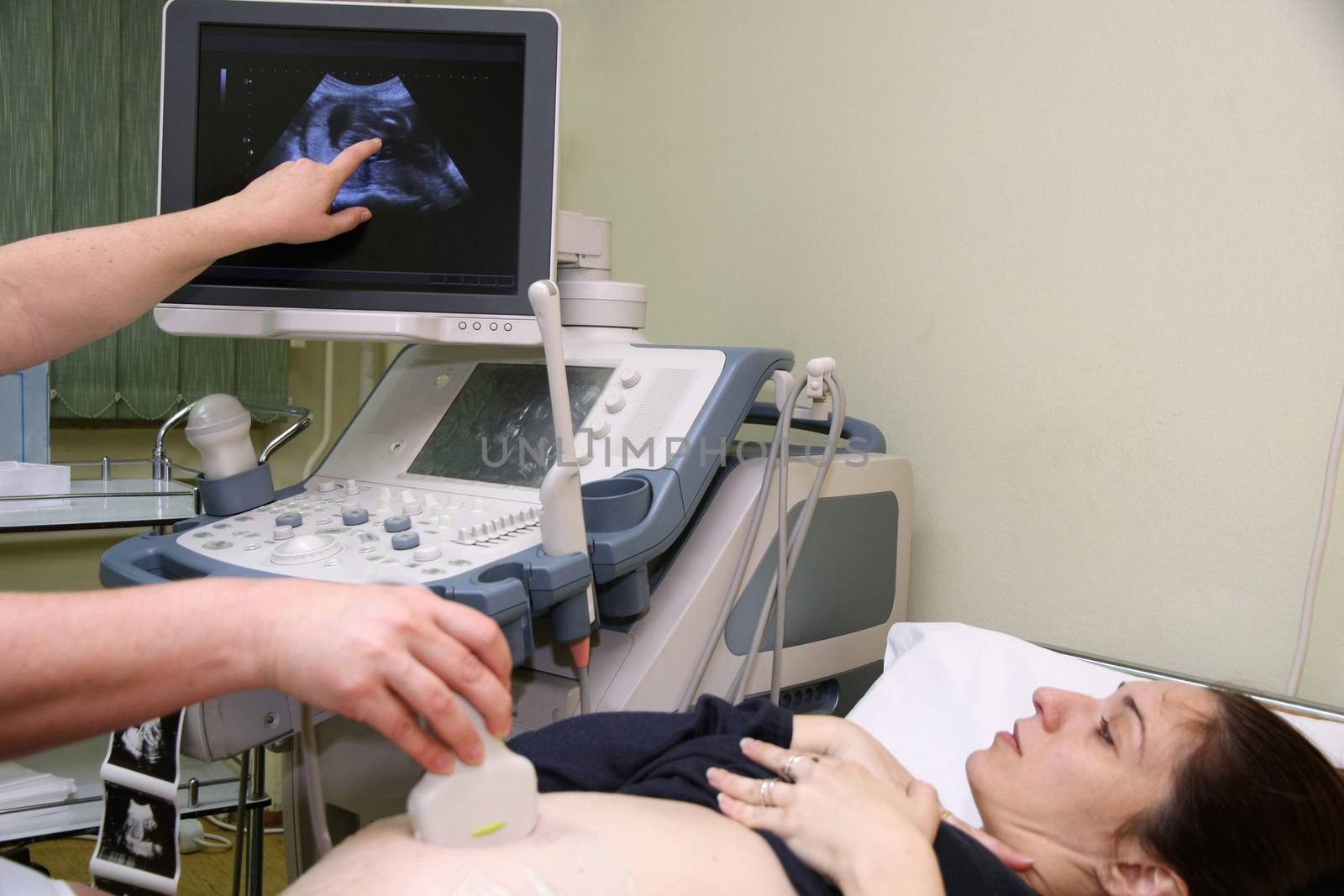 Pregnant woman and doctor hand's with ultrasound equipment during ultrasound medical examination