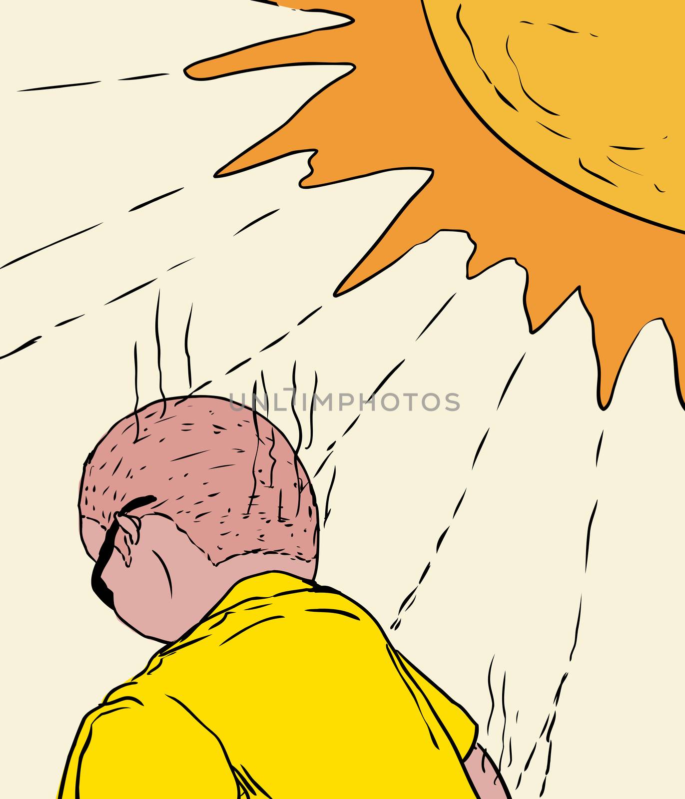 Illustration of man with back of head and arm getting sunburned