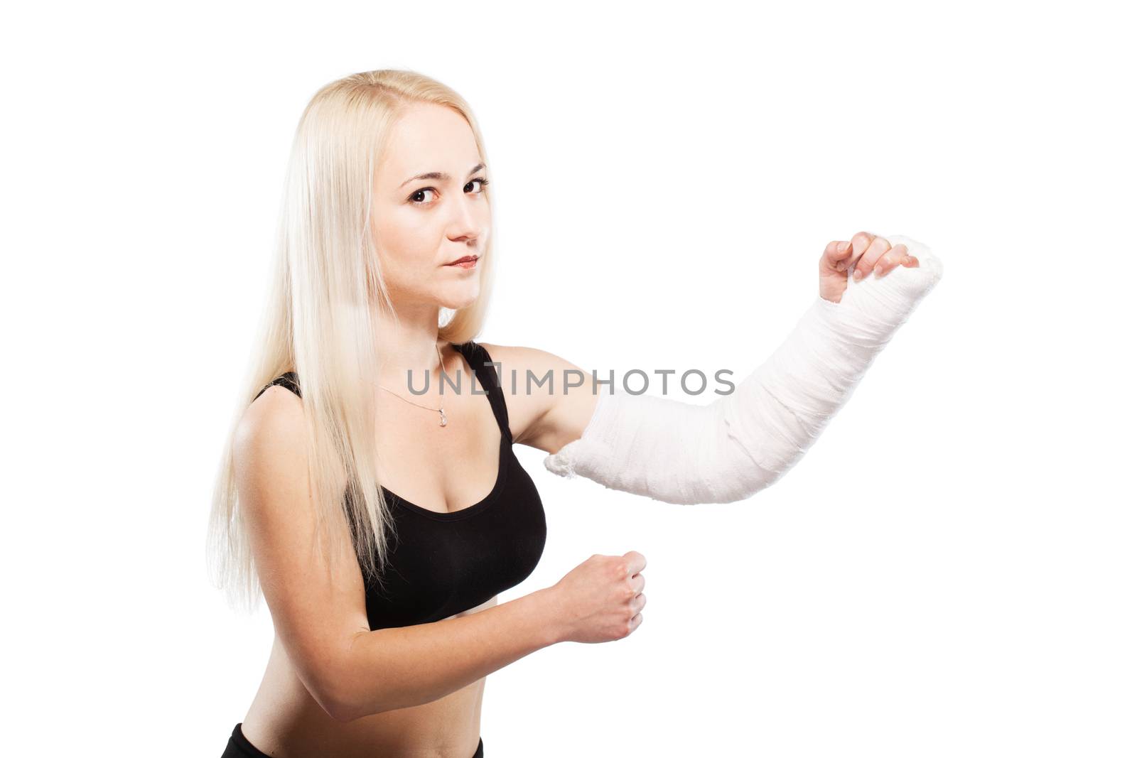 Fitness girl with a broken arm by kokimk