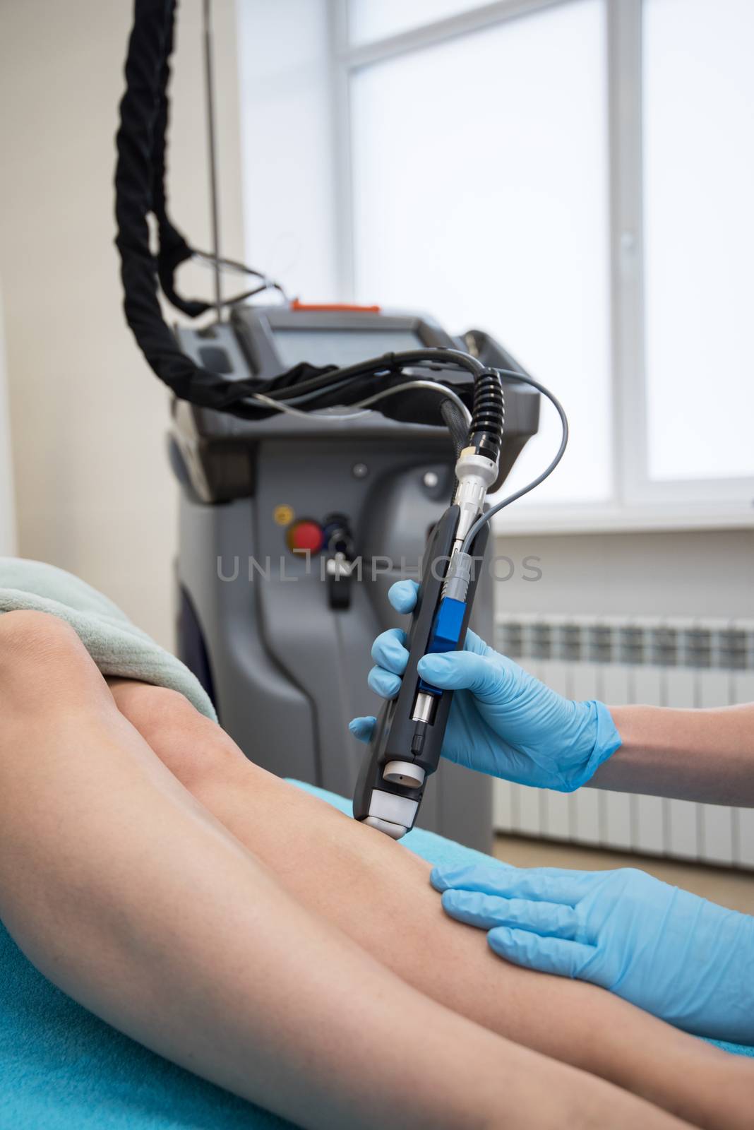 Laser hair removal on ladies legs