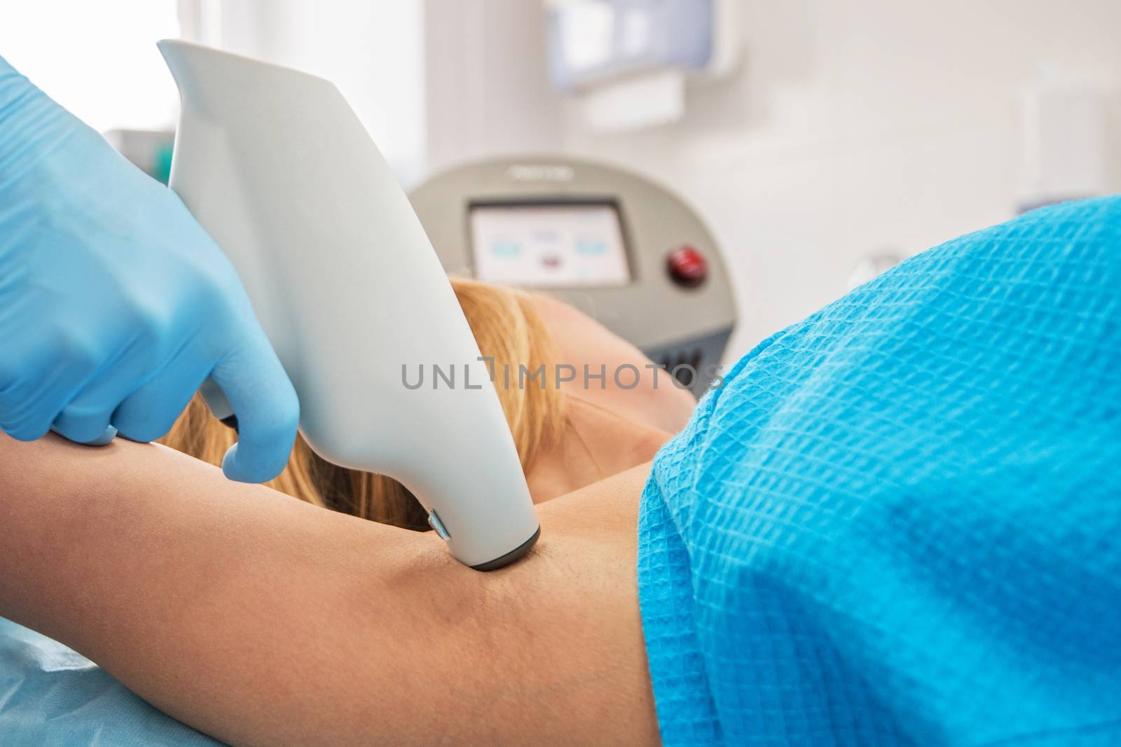 Procedure for armpit against hyperhidrosis