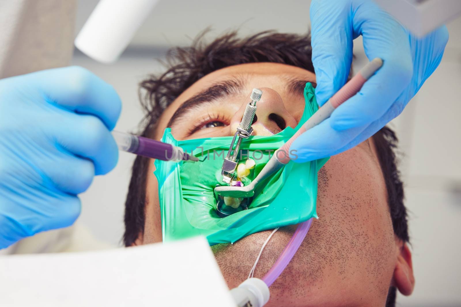 Dentist office - young man in the dentist chair