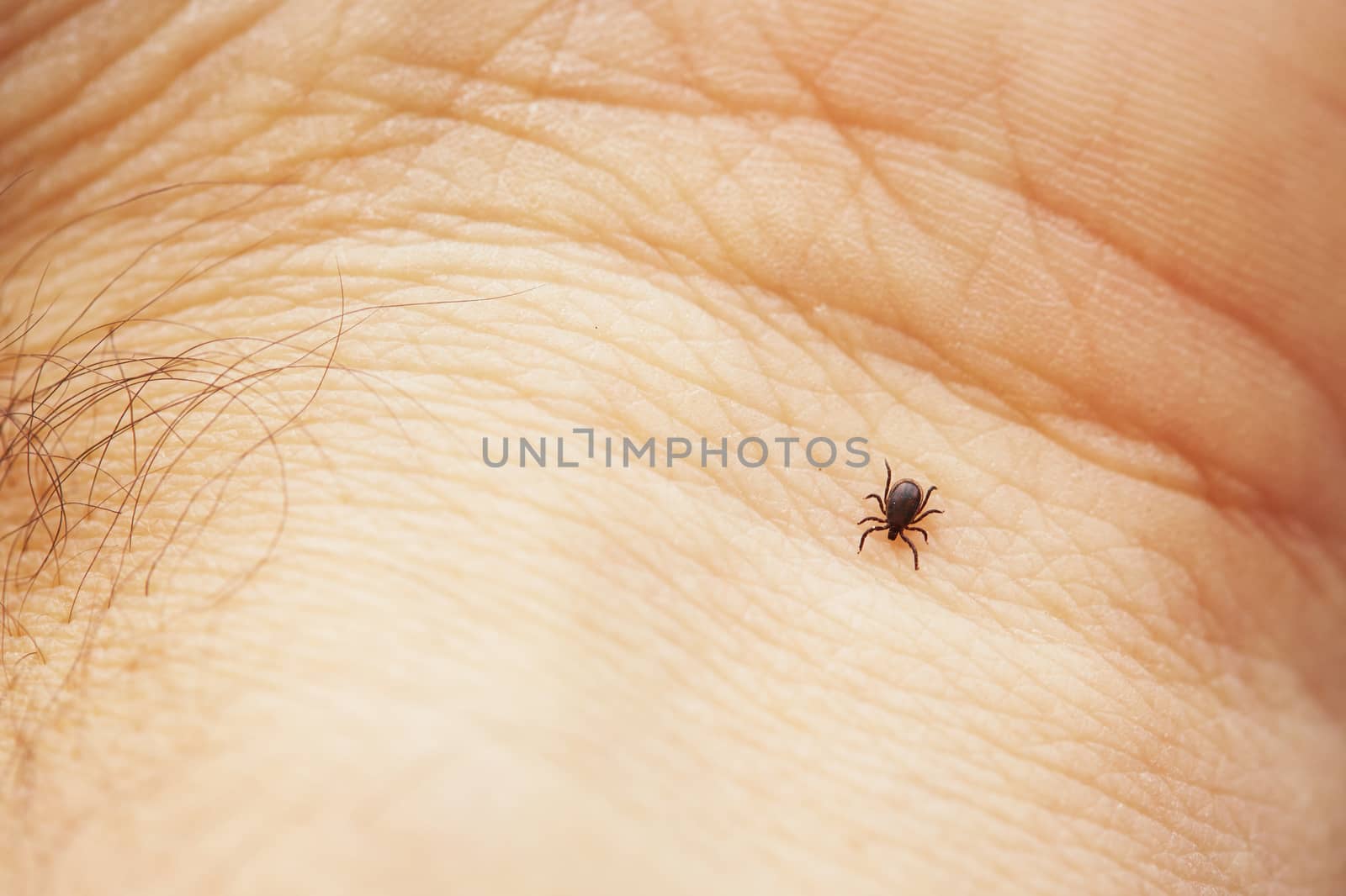 Tick is crawling on the human palm