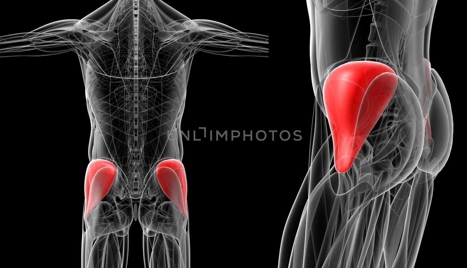 medical  illustration of the gluteus medius