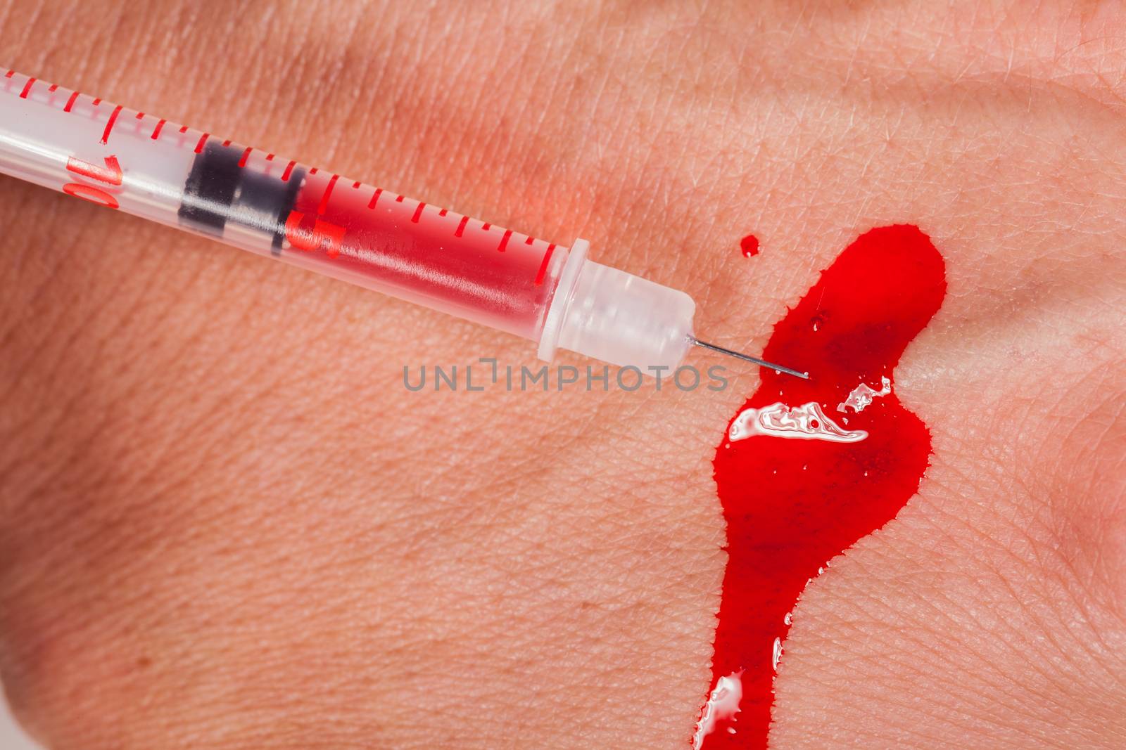 Subcutaneous medical injection concept by juniart