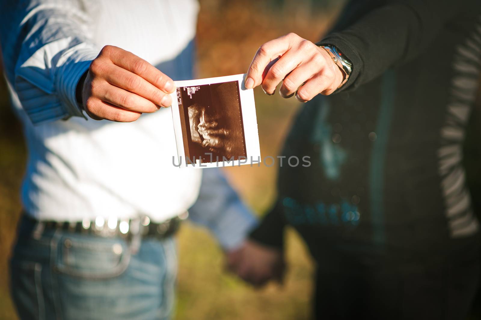 ultrasound pictures by fotoutrinek