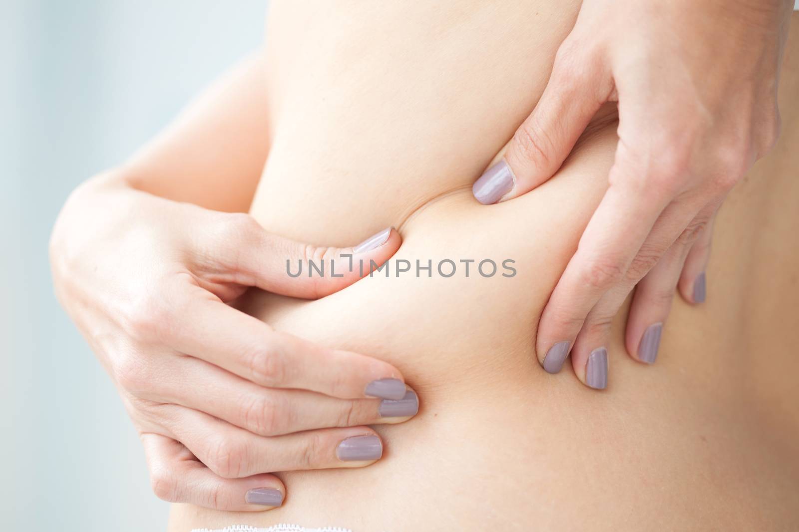 Localized fat in woman back