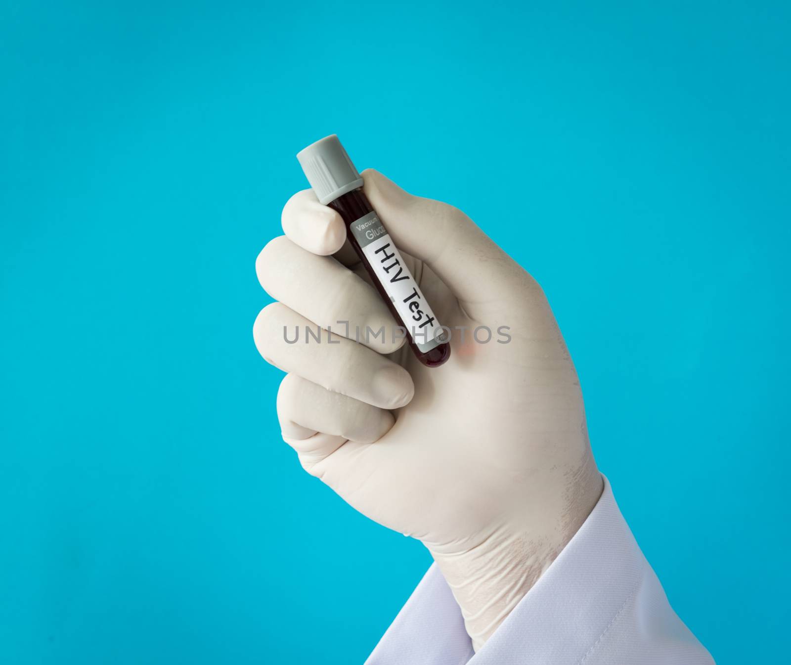 Hand with latex glove holding blood sample for hiv test.