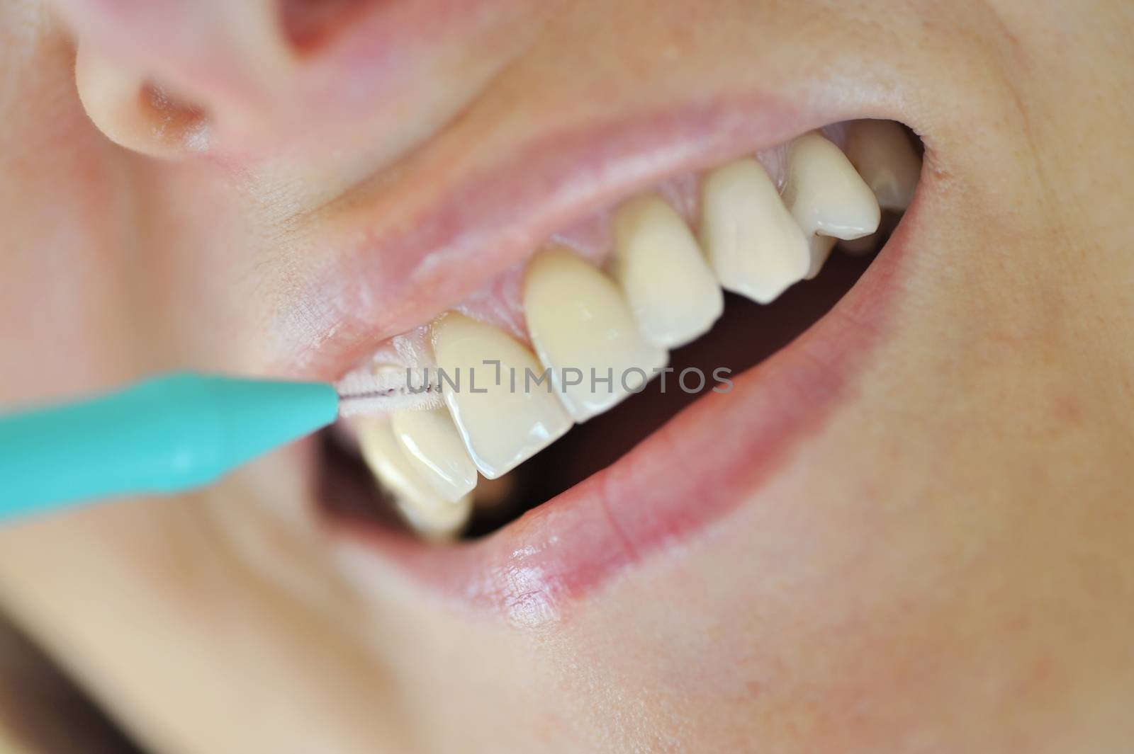 Interdental brush- Woman Cleaning Her Teeth