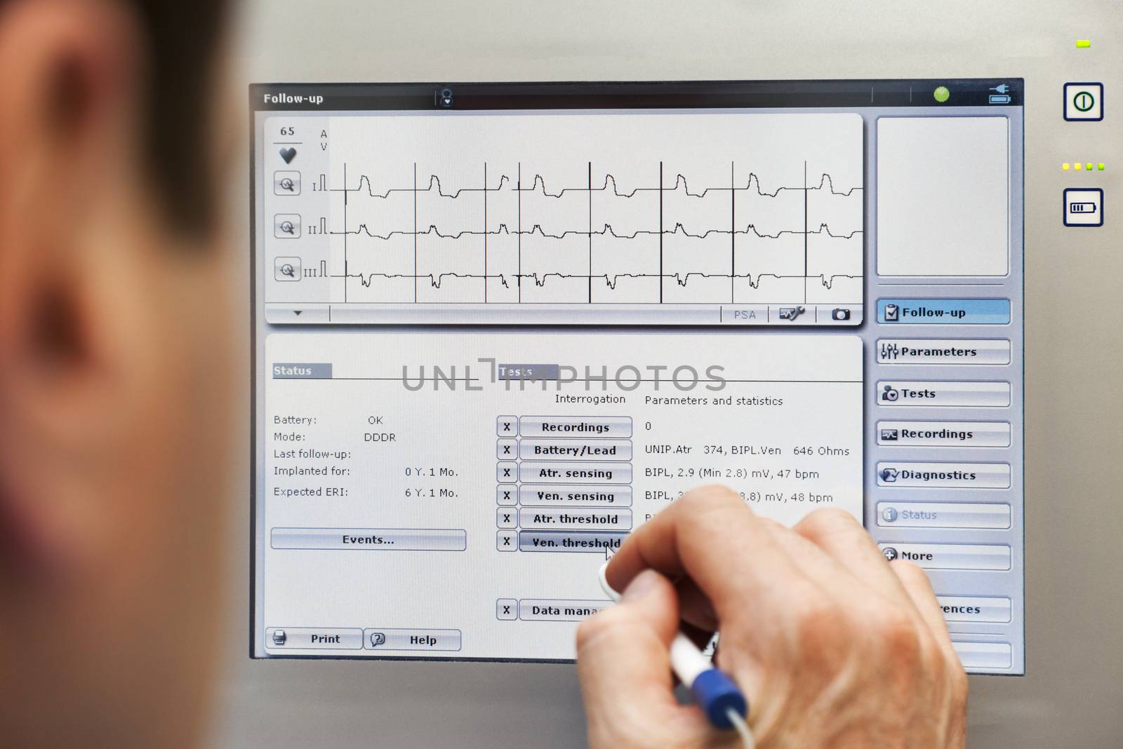 A doctor is checking a readings from a pacemaker on a monitor.