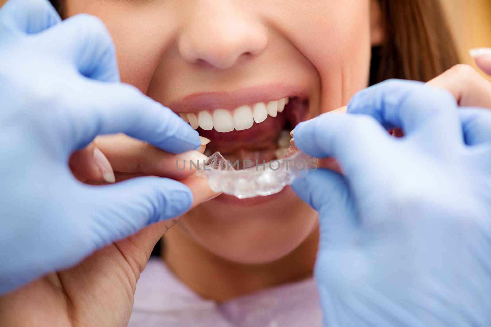 Dentist showing to the female patient how to use mobile orthodontic appliance for dental correction. Close-up.