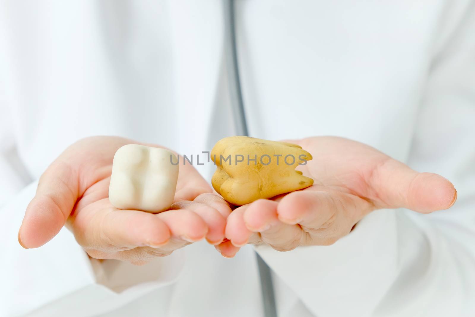 dentist holding molar,dental concept