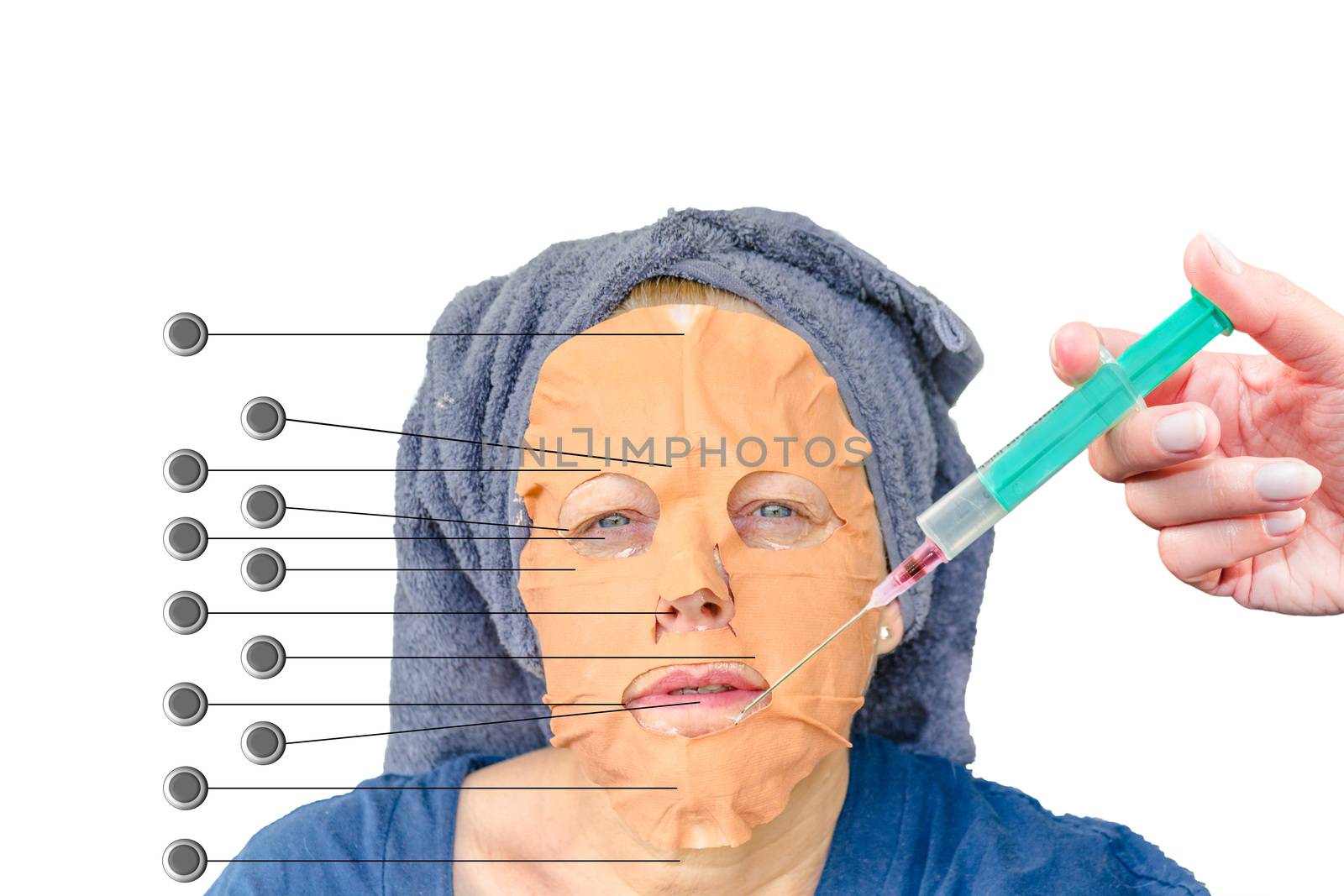 Close-up portrait of a cosmetic face mask and an injection with botulinum toxin in the female face lip zone.
