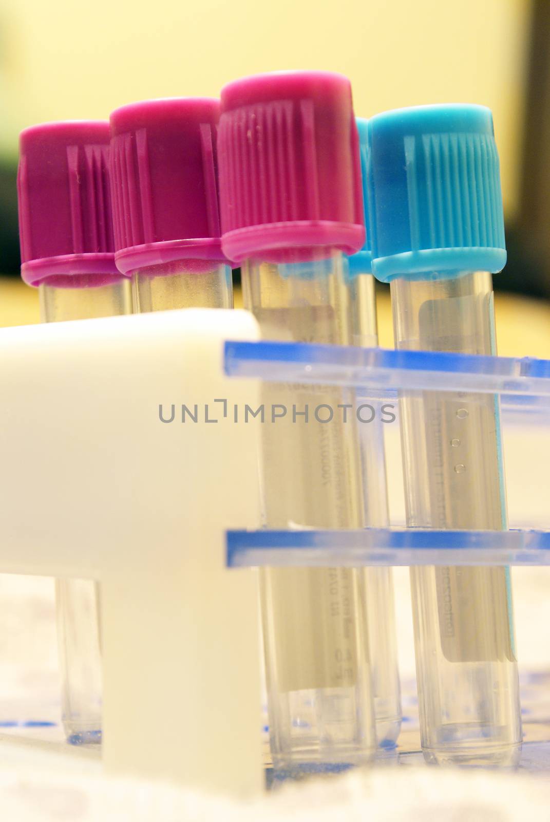 Test Tube Analysis by AlphaBaby