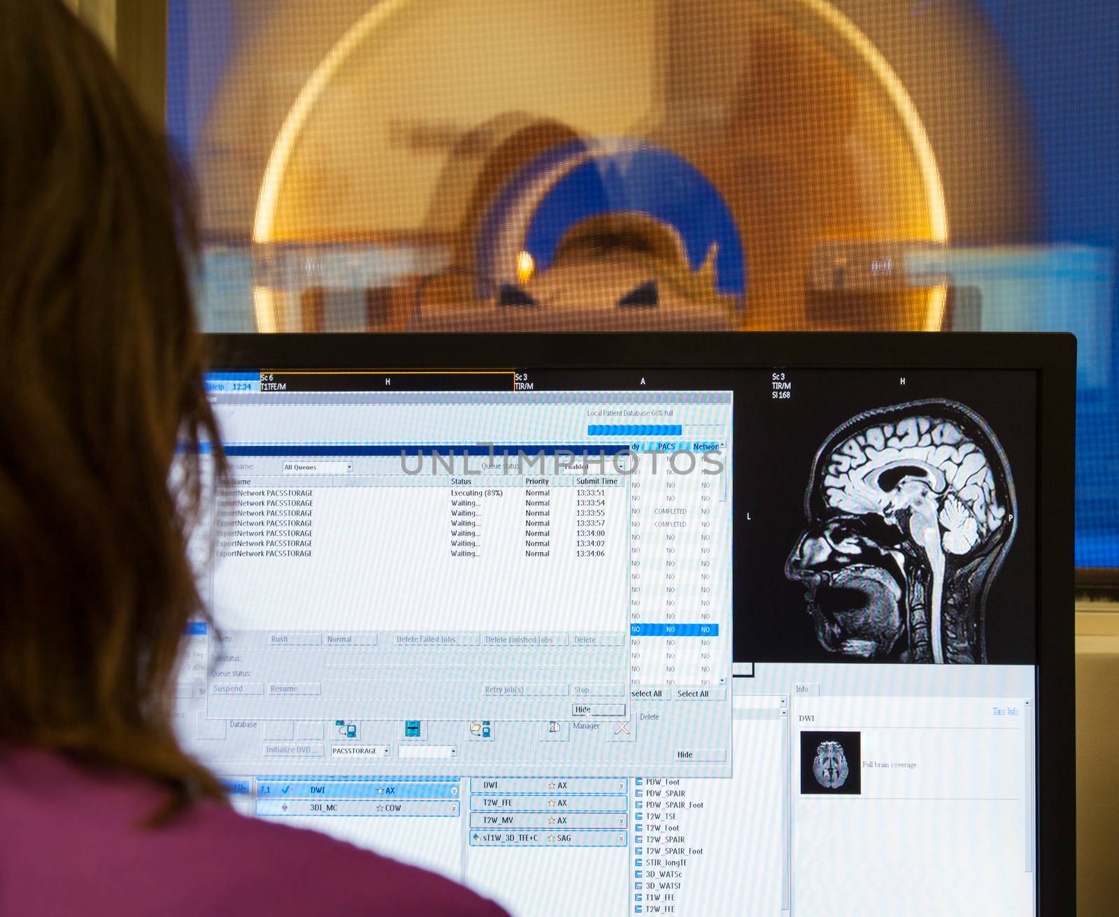 An operator is looking at images of scanned on MRI human brain in modern hospital.