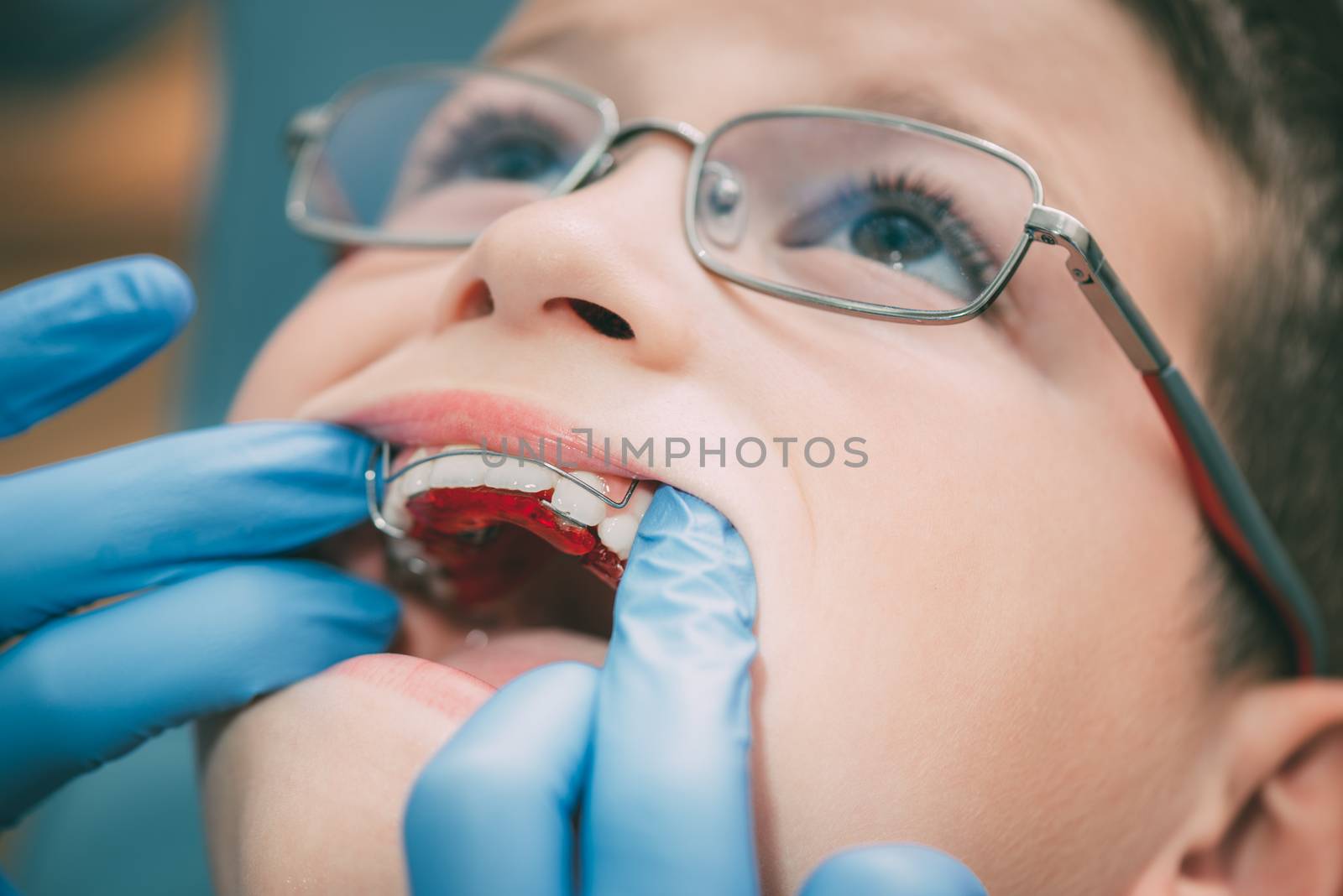 Dentist checking mobile orthodontic appliance for dental correction to the child patient. Close-up. Real People.