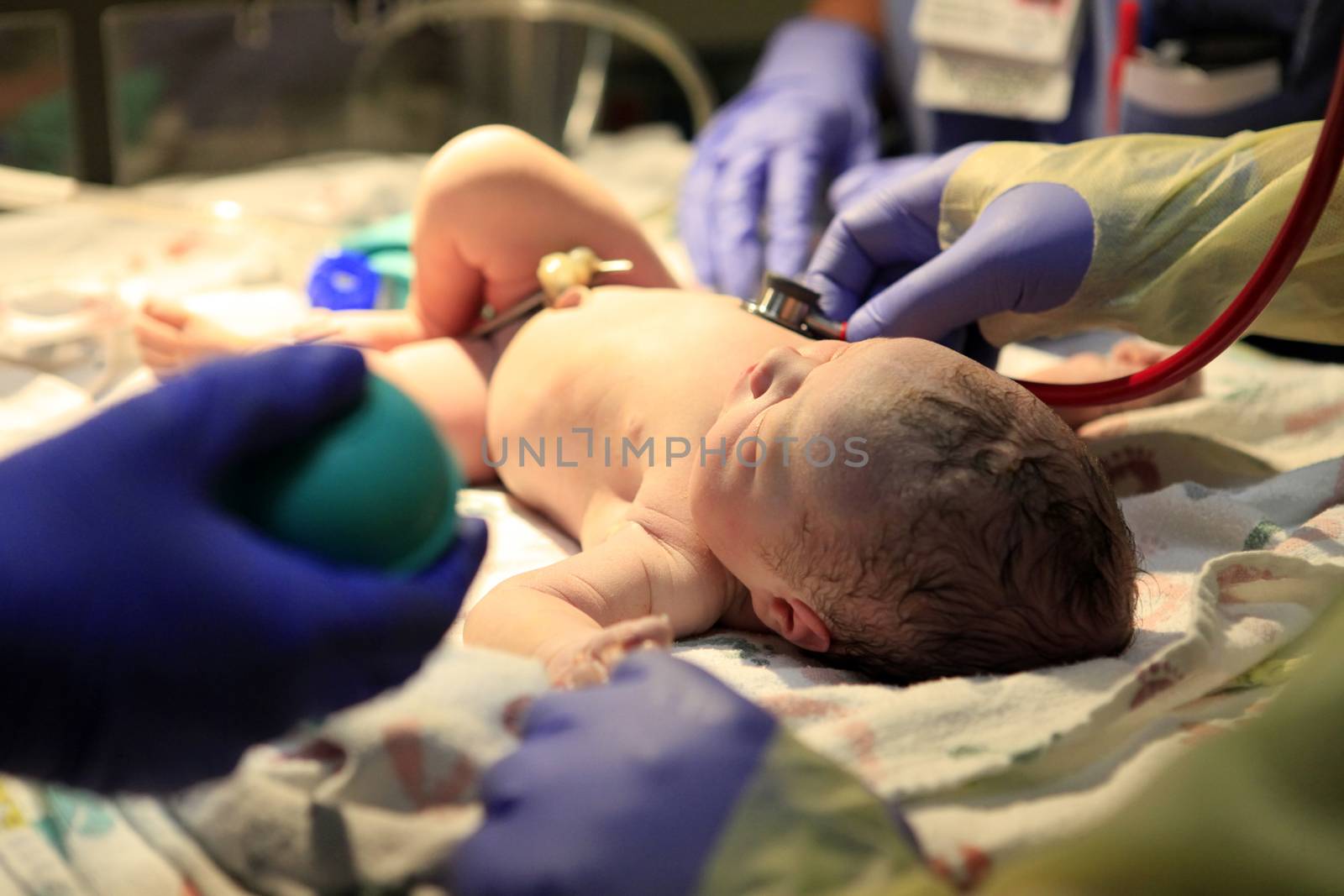 The first minutes of life of the newborn girl