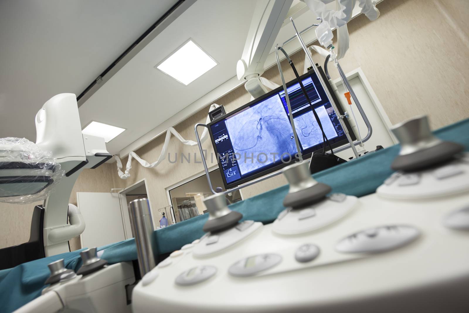 A modern hospital heart surgery room with monitor and scanner.