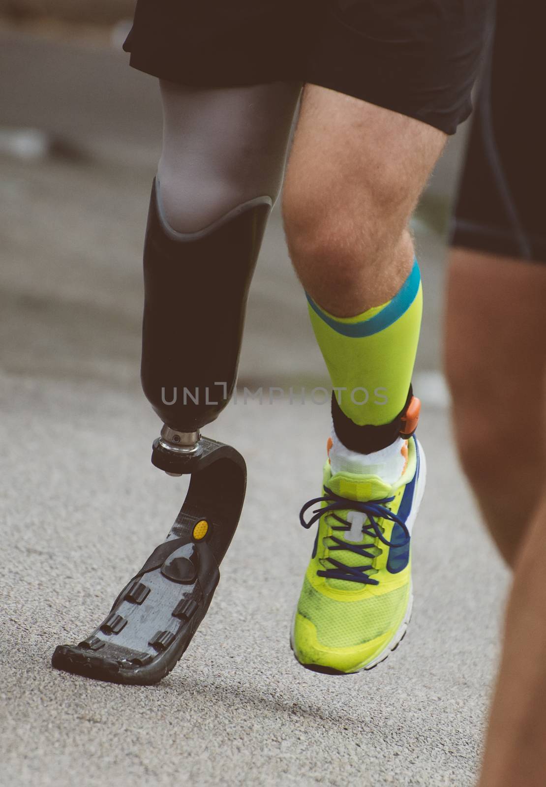 Man running with prosthetic leg on the street.