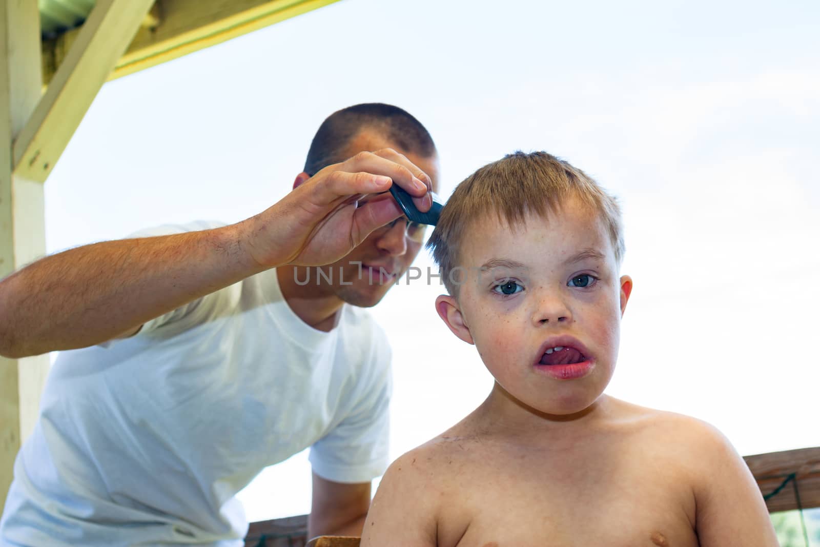 Cute Little Boy With Downs Syndrome Geting His Haircut