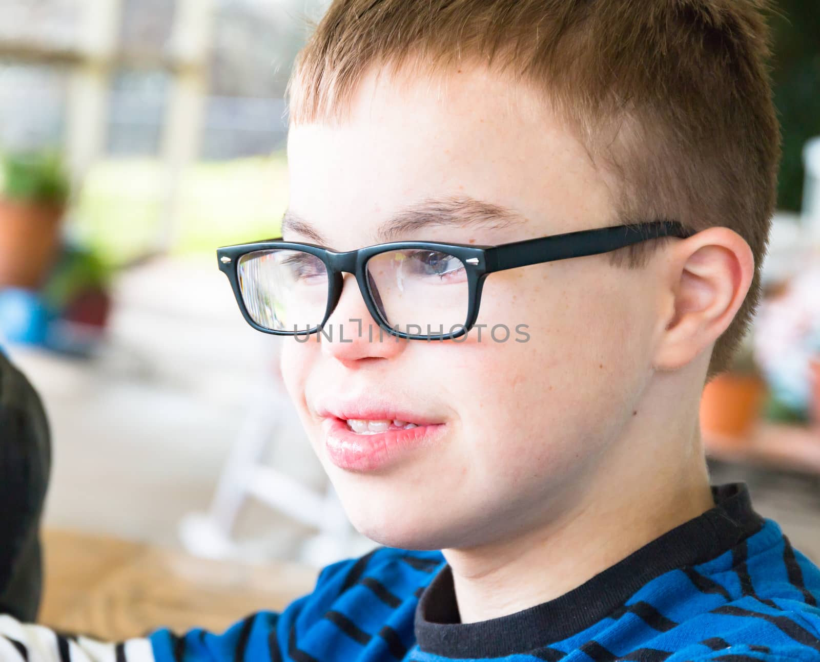 Close up of Young Boy With Downs Syndrome