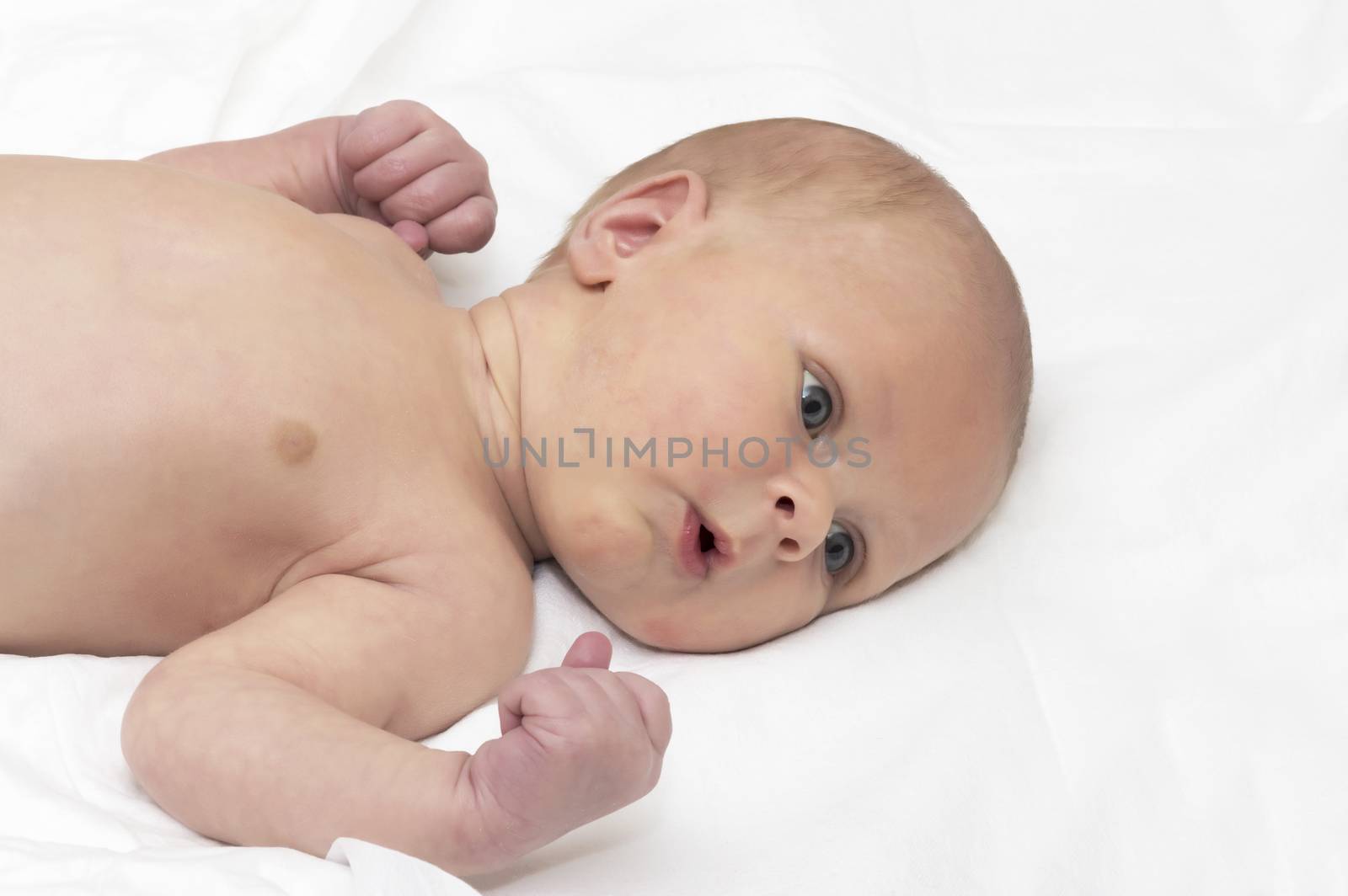 Boy newborn jaundice lying on white bedsheet